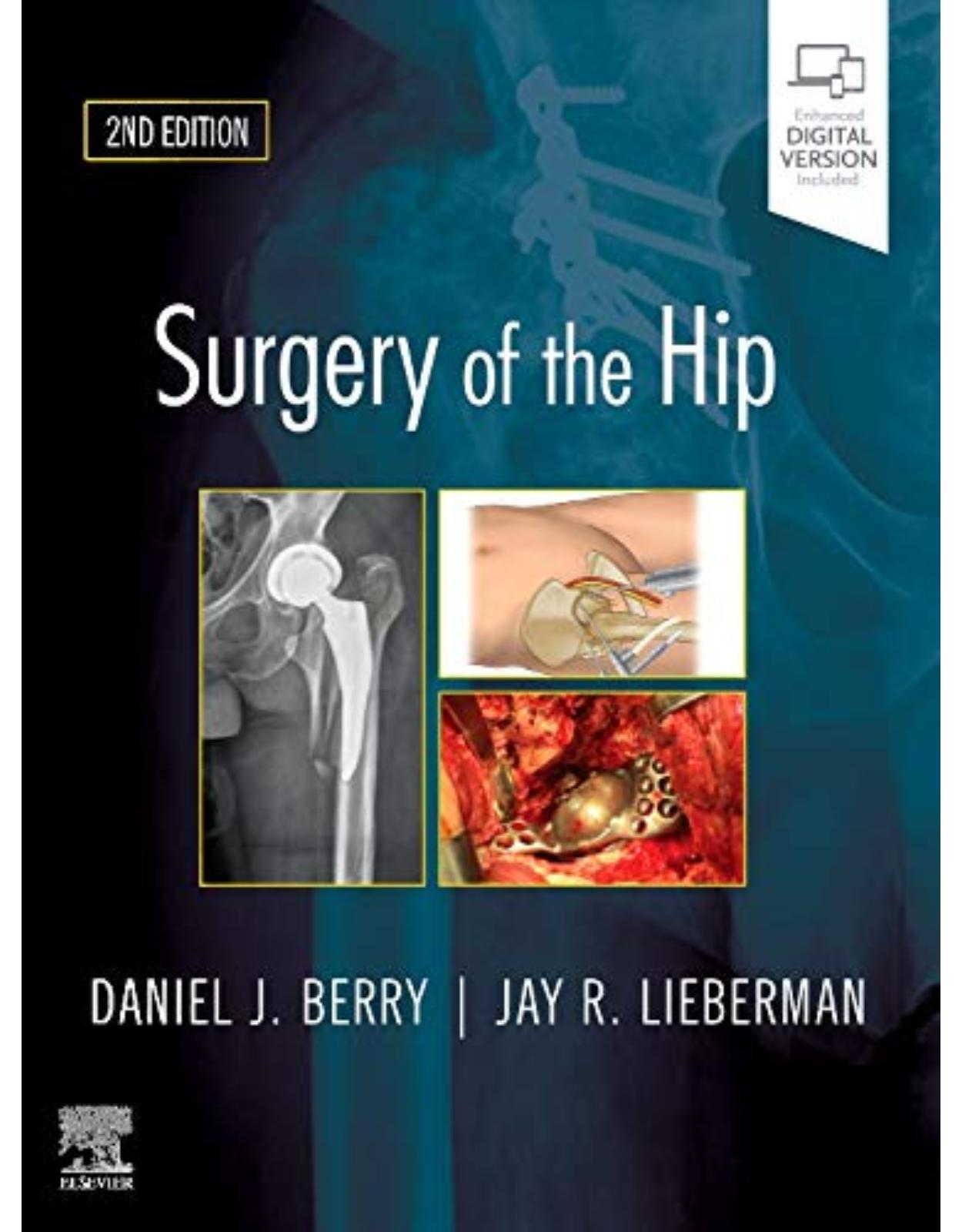 Surgery of the Hip, 2nd Edition