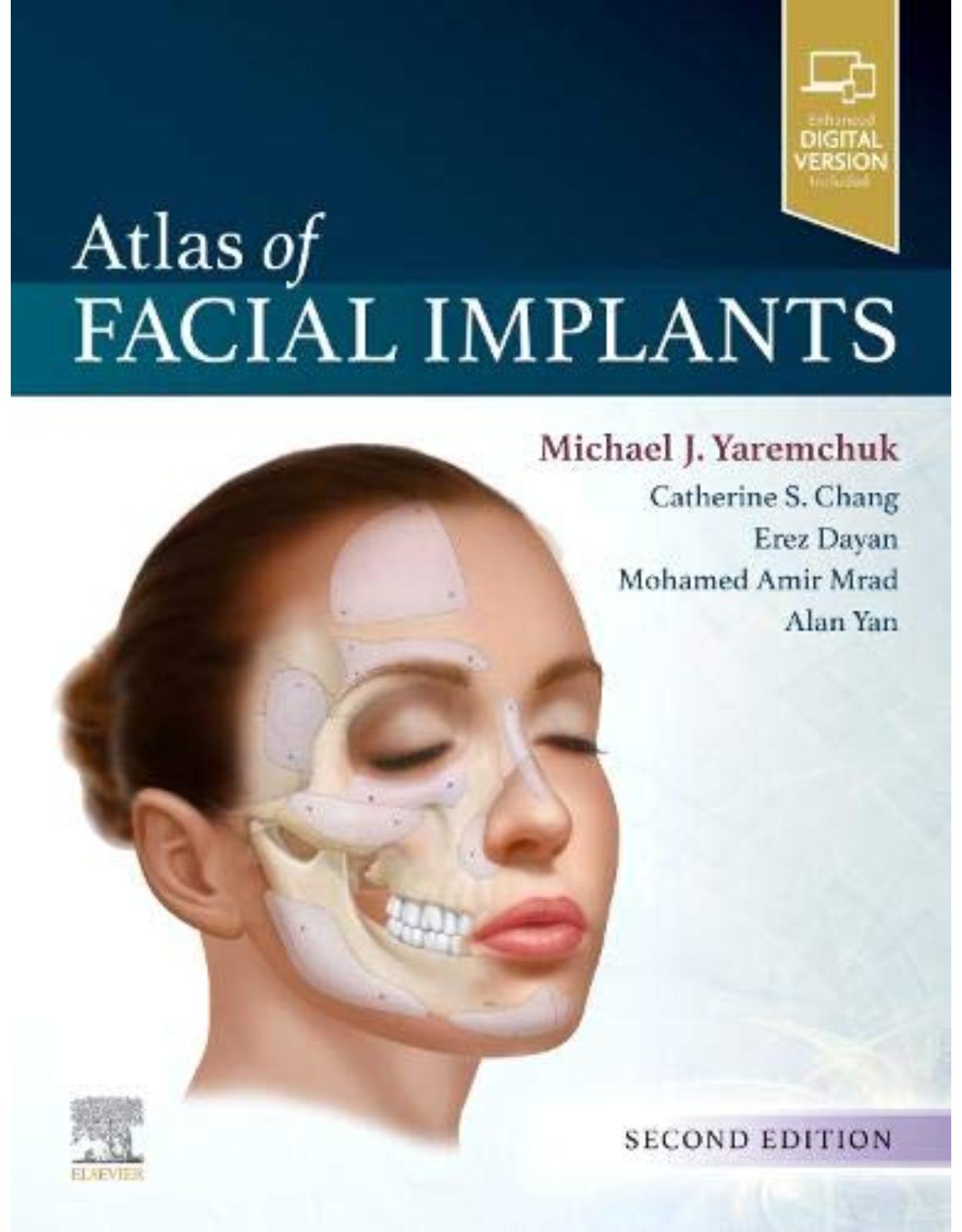 Atlas of Facial Implants, 2nd Edition