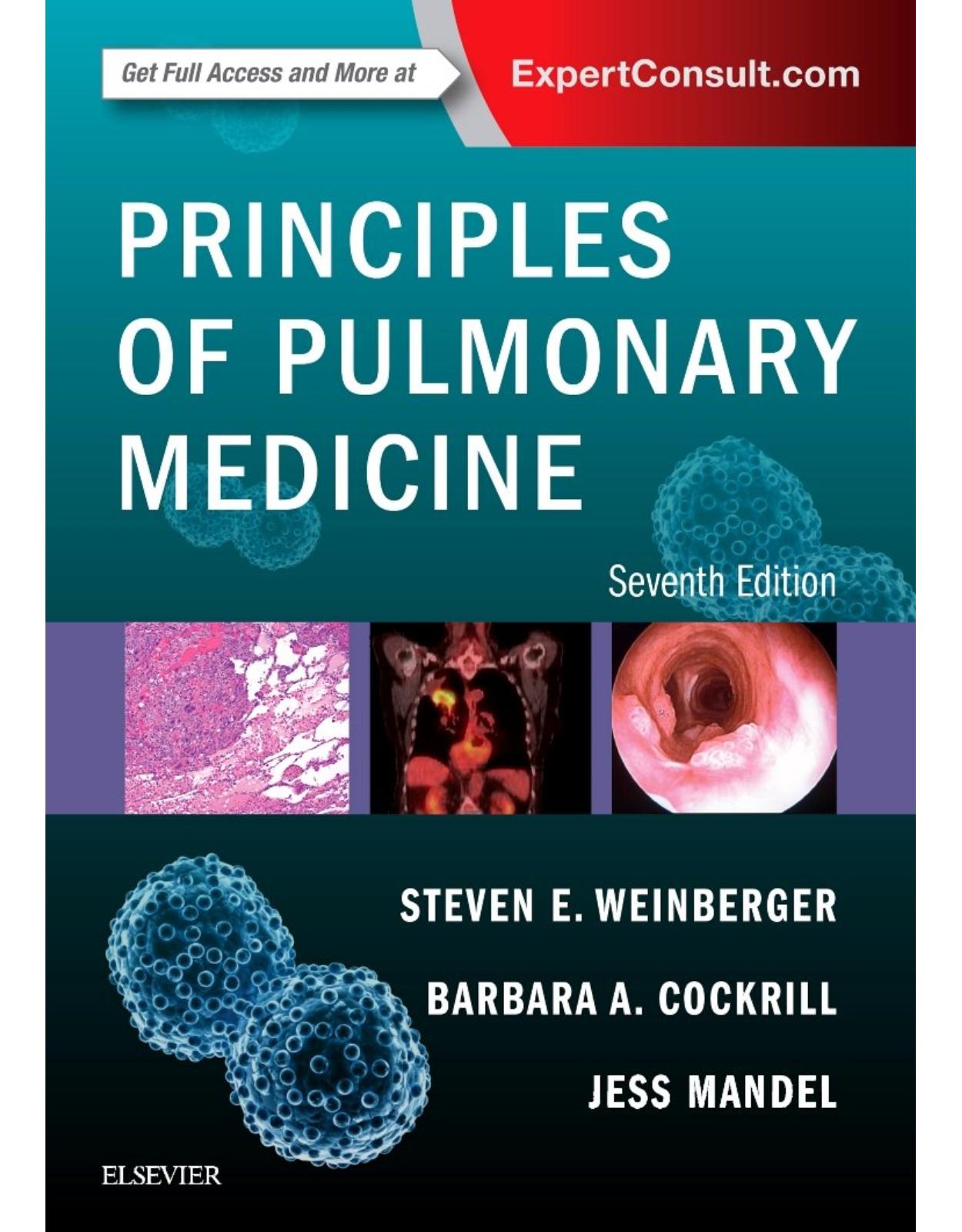 Principles of Pulmonary Medicine, 7e