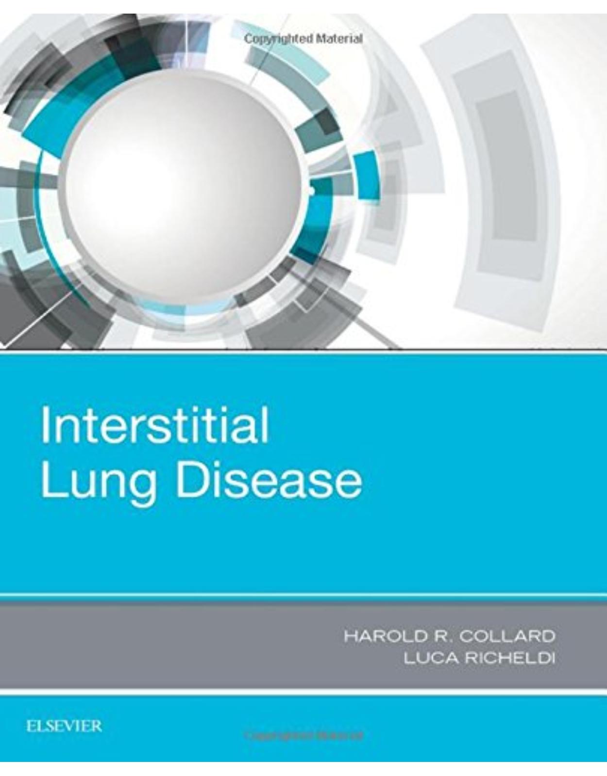 Interstitial Lung Disease, 1e