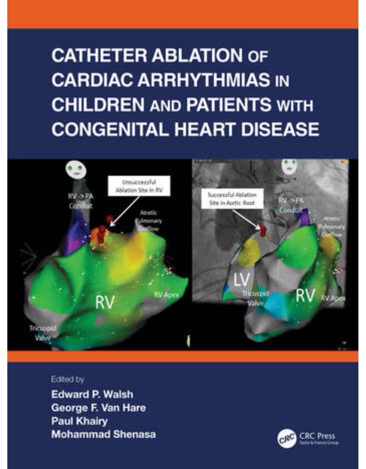 Catheter Ablation of Cardiac Arrhythmias in Children and Patients with Congenital Heart Disease