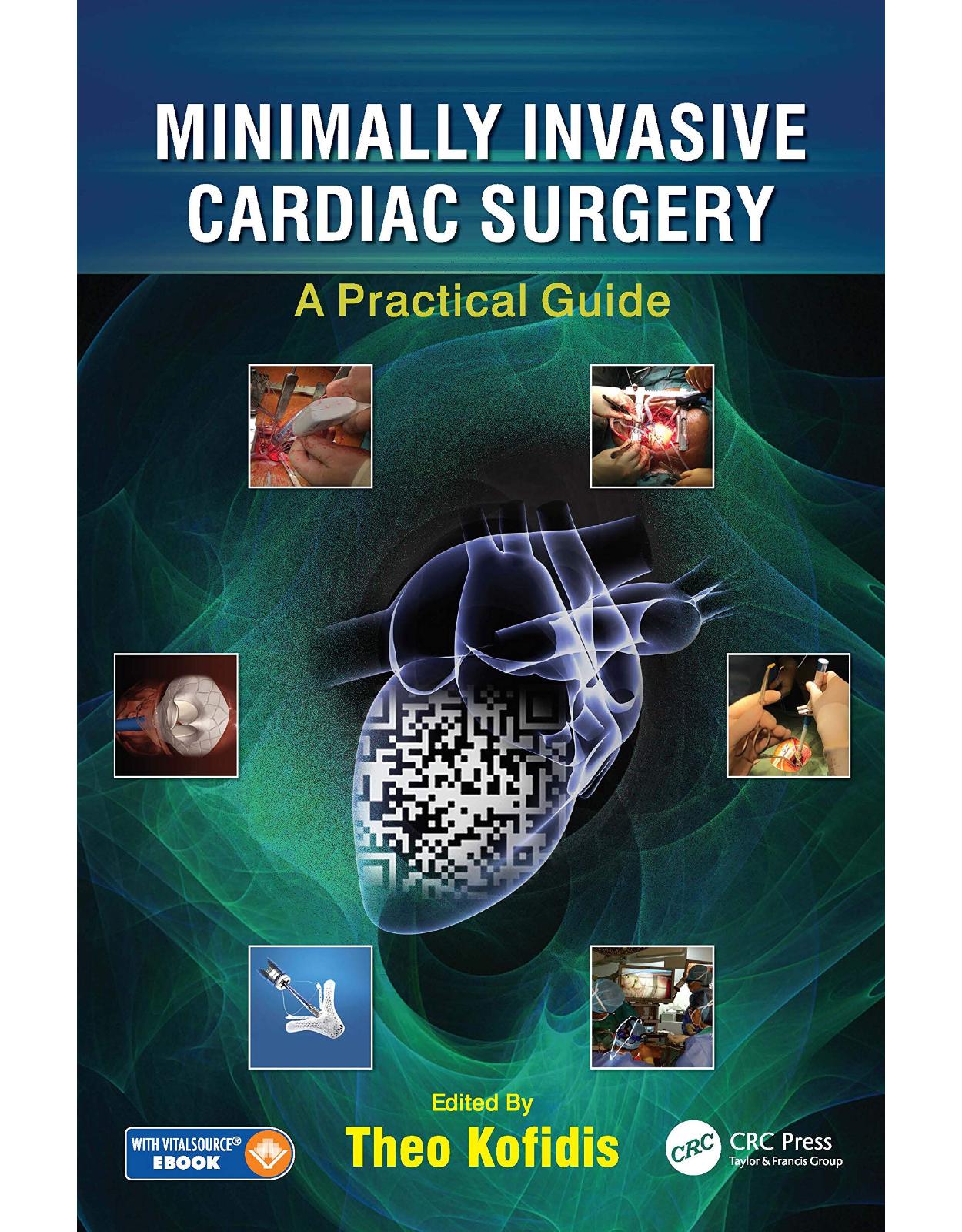 Minimally Invasive Cardiac Surgery: A Practical Guide