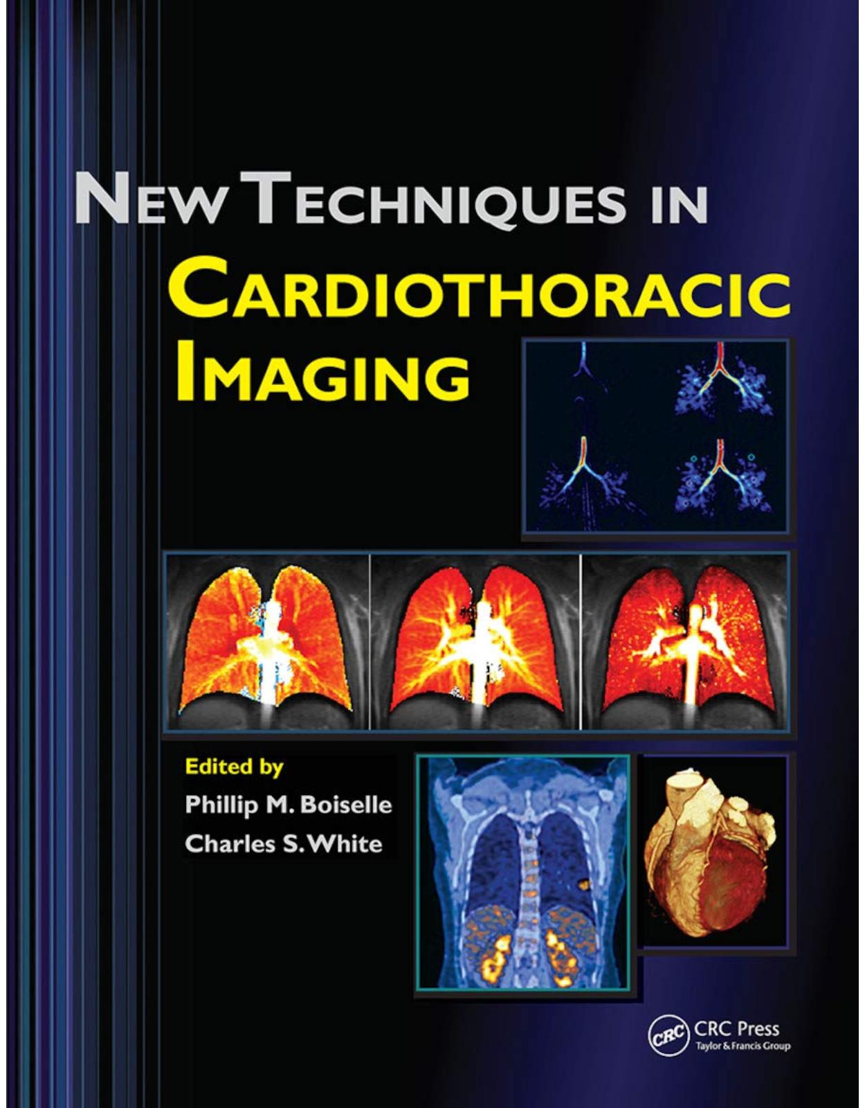 New Techniques in Cardiothoracic Imaging