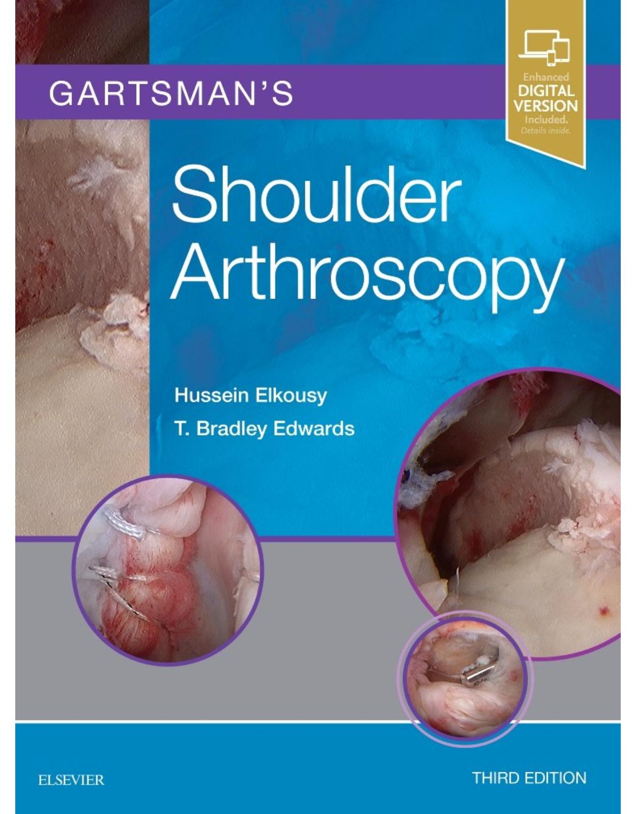 Gartsman’s Shoulder Arthroscopy, 3e 