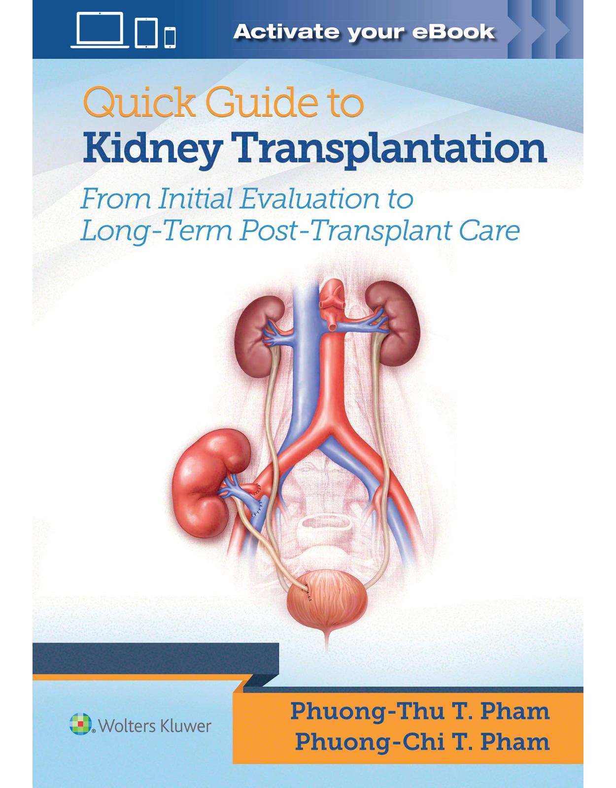 Quick Guide to Kidney Transplantation