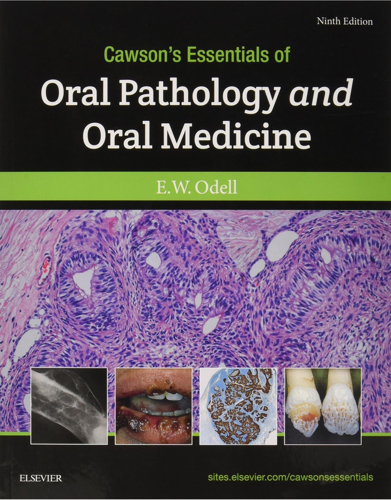 Cawson’s Essentials of Oral Pathology and Oral Medicine, 9e 