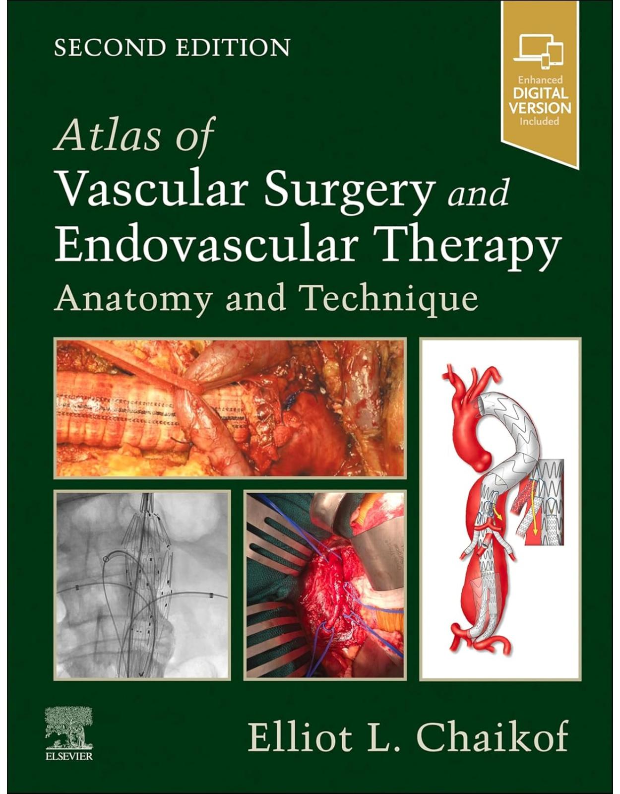 Atlas of Vascular Surgery and Endovascular Therapy : Anatomy and Technique