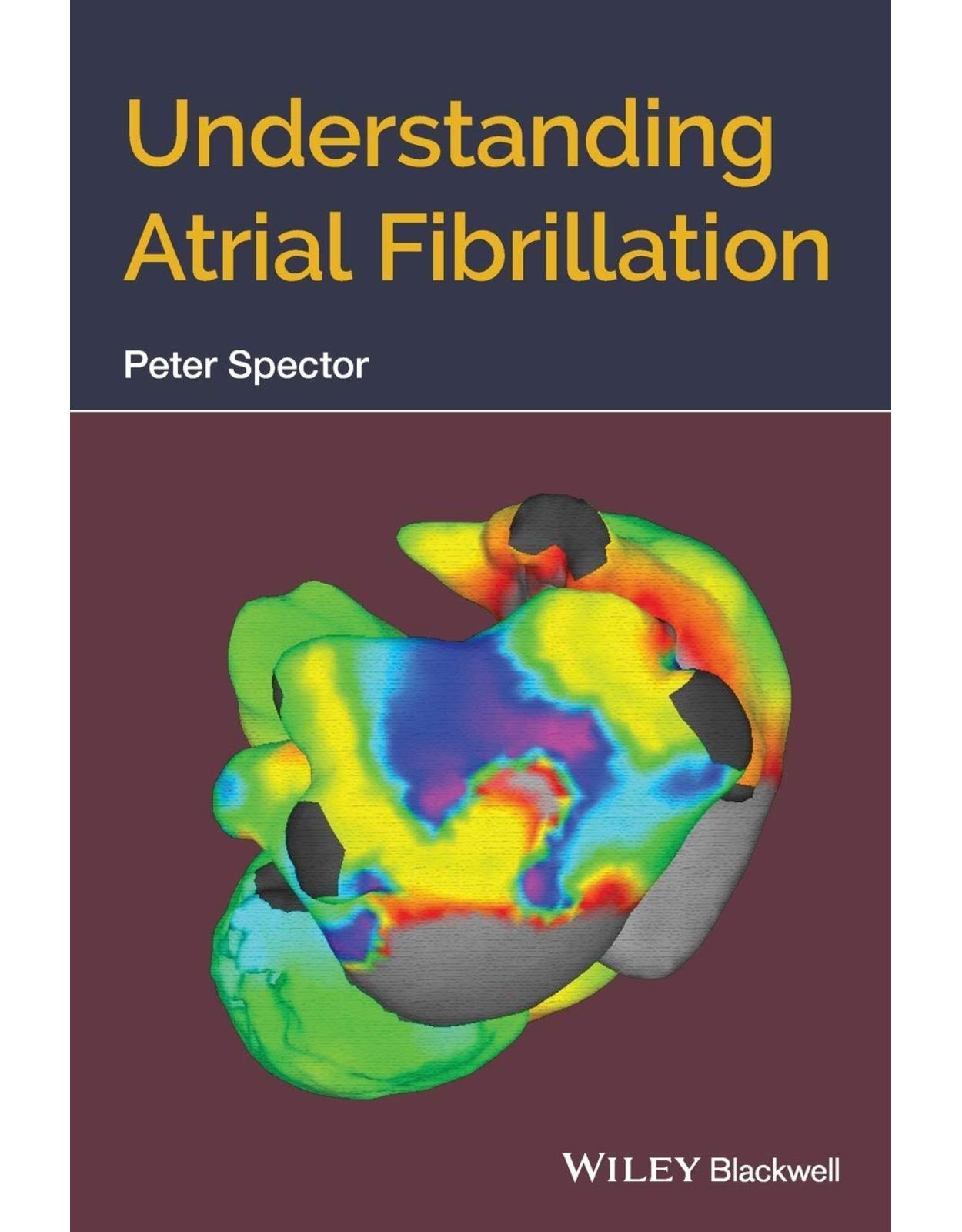 Understanding Atrial Fibrillation