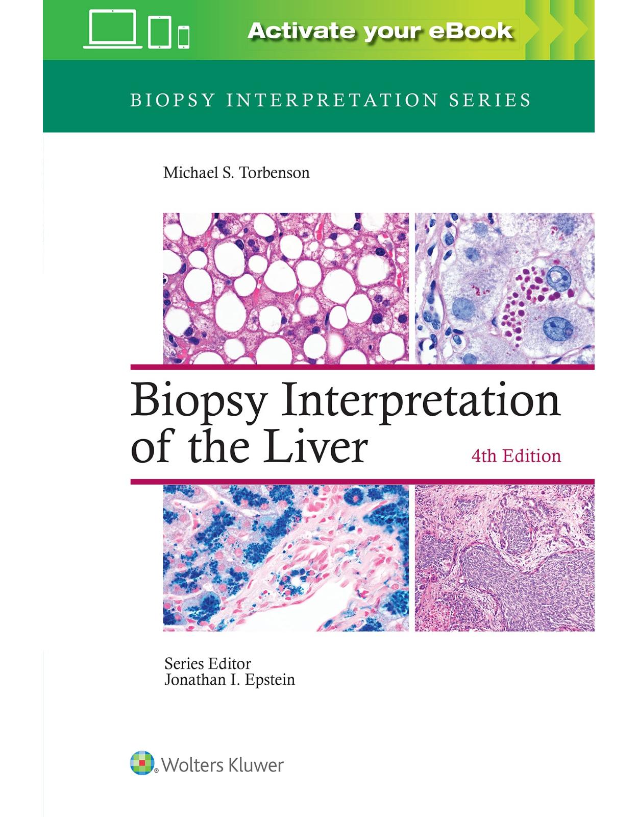 Biopsy Interpretation of the Liver 4th edition