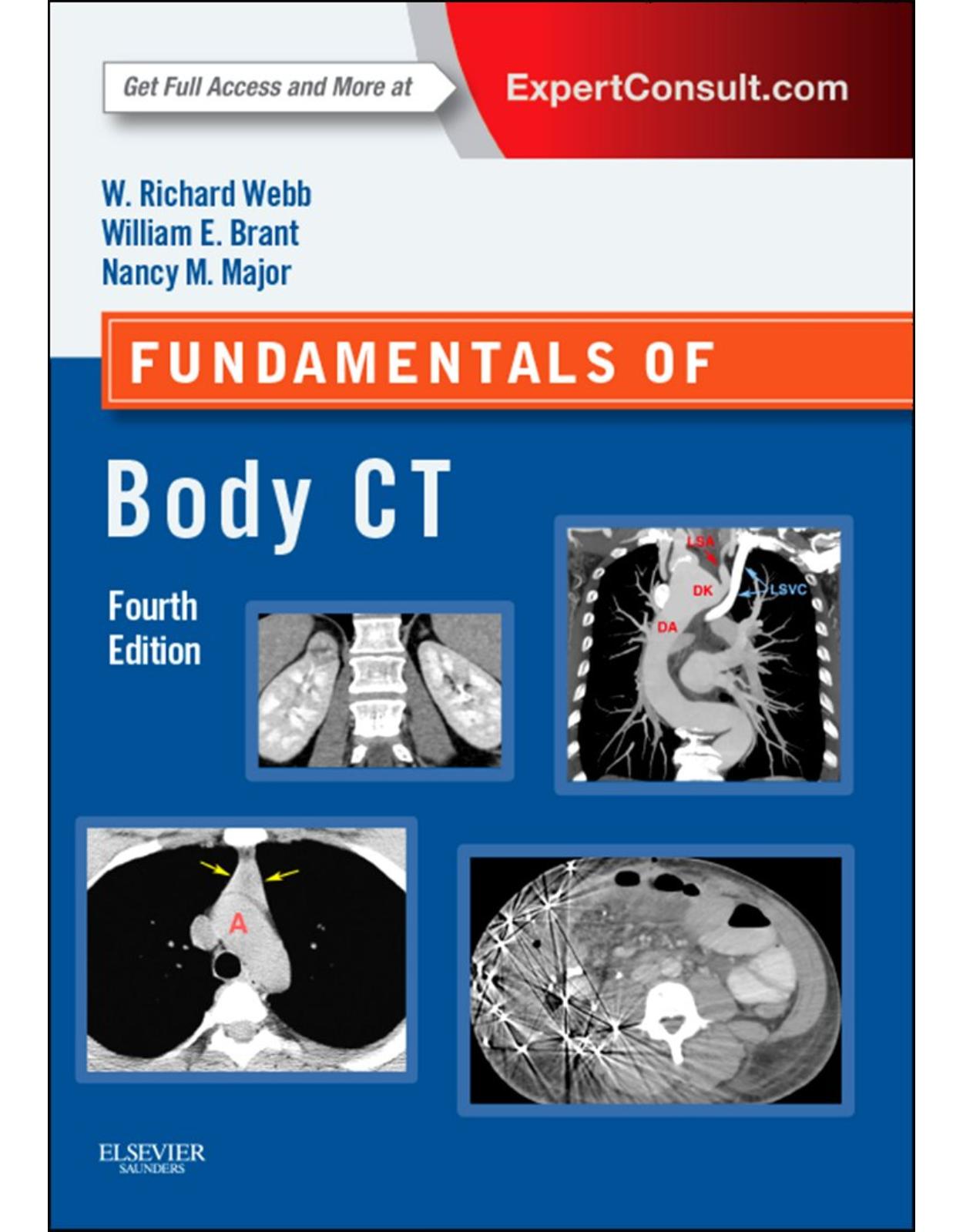 Fundamentals of Body CT, 4e (Fundamentals of Radiology)