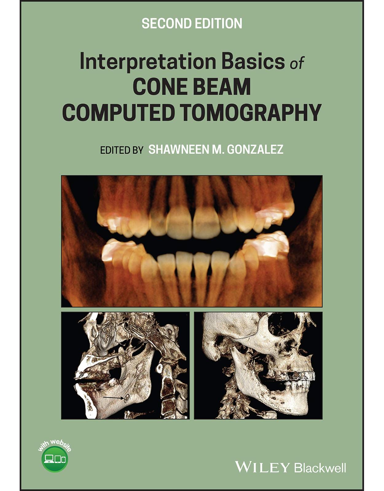 Interpretation Basics of Cone Beam Computed Tomography