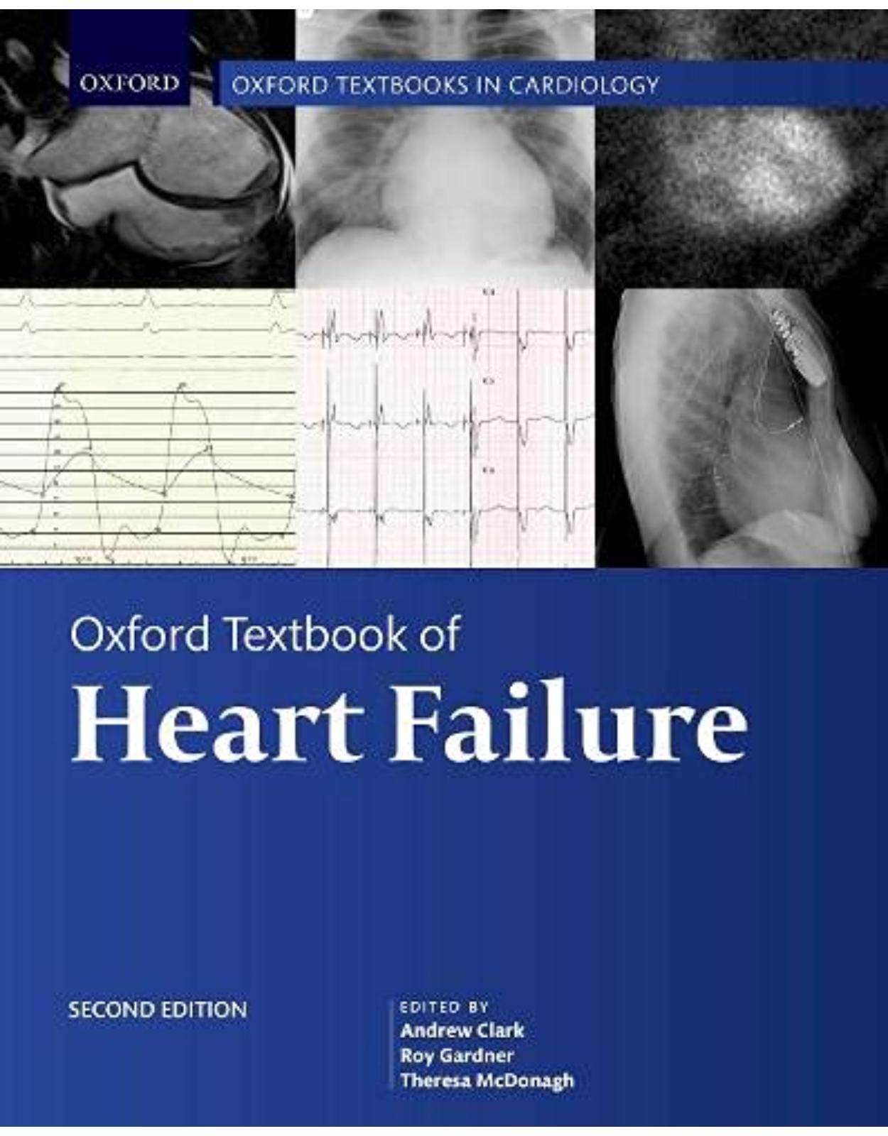 Oxford Textbook of Heart Failure