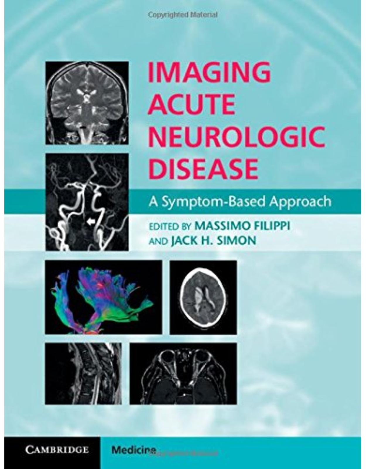 Imaging Acute Neurologic Disease: A Symptom-Based Approach