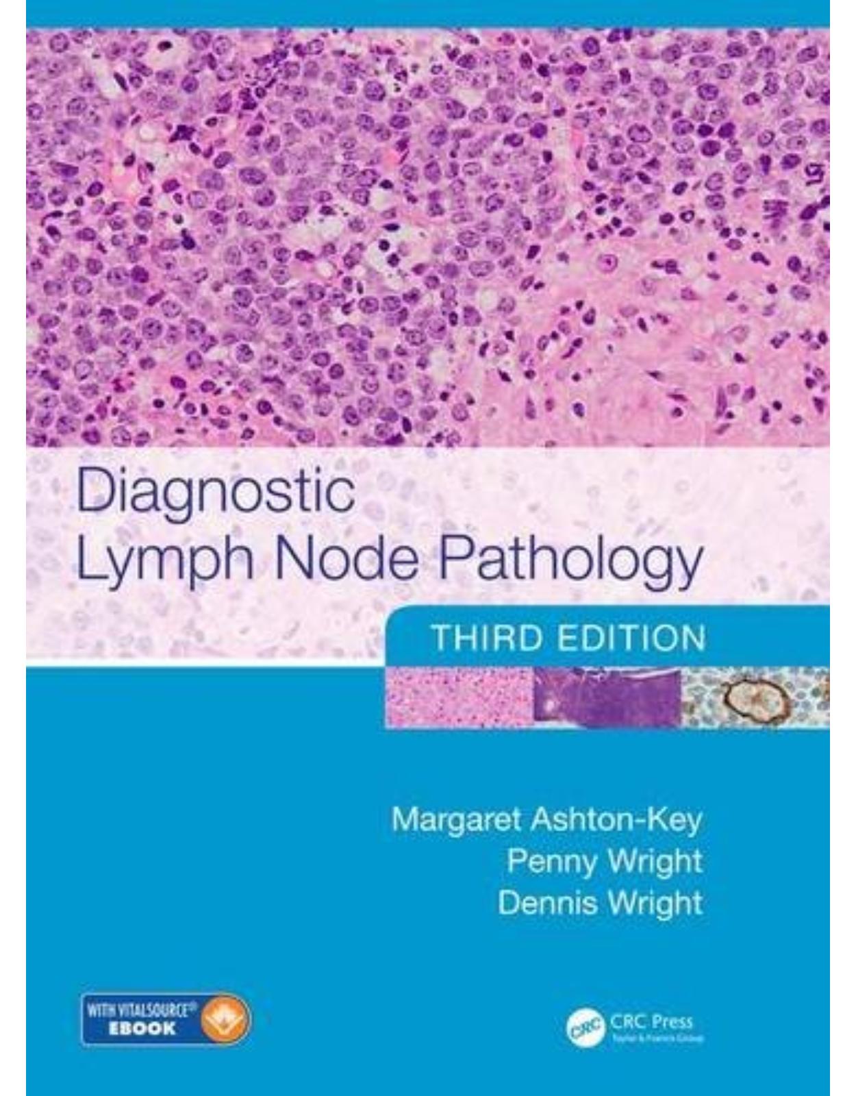 Diagnostic Lymph Node Pathology, Third Edition