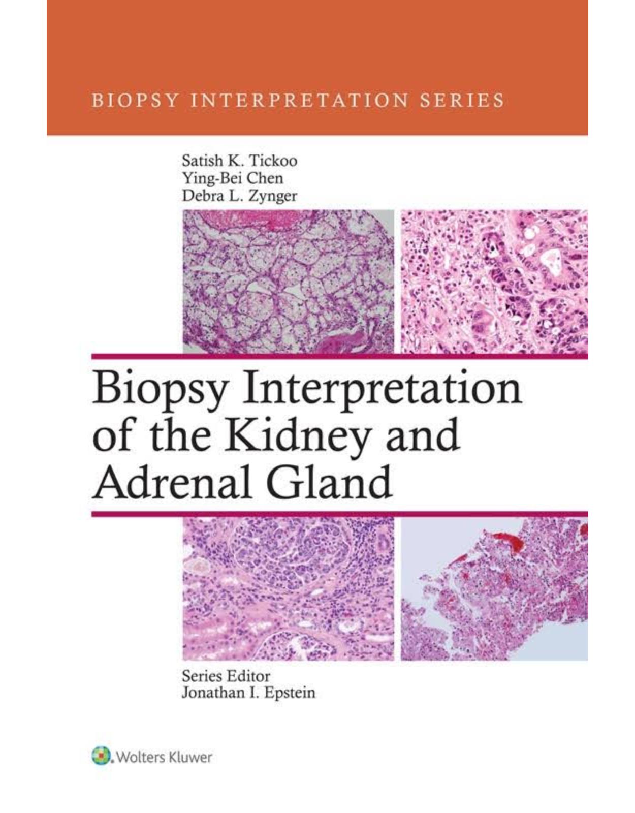 Biopsy Interpretation of the Kidney & Adrenal Gland 