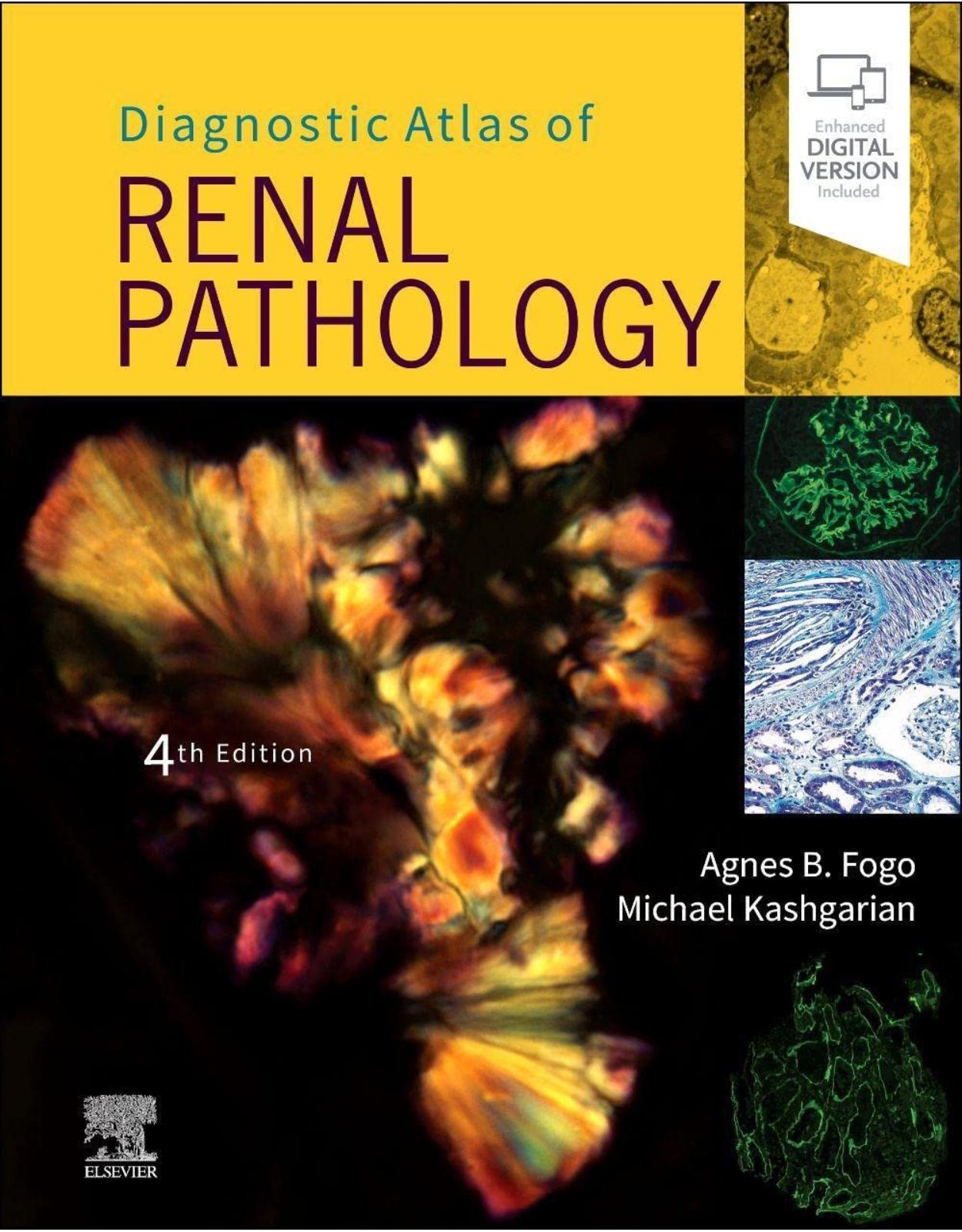 Diagnostic Atlas of Renal Pathology 