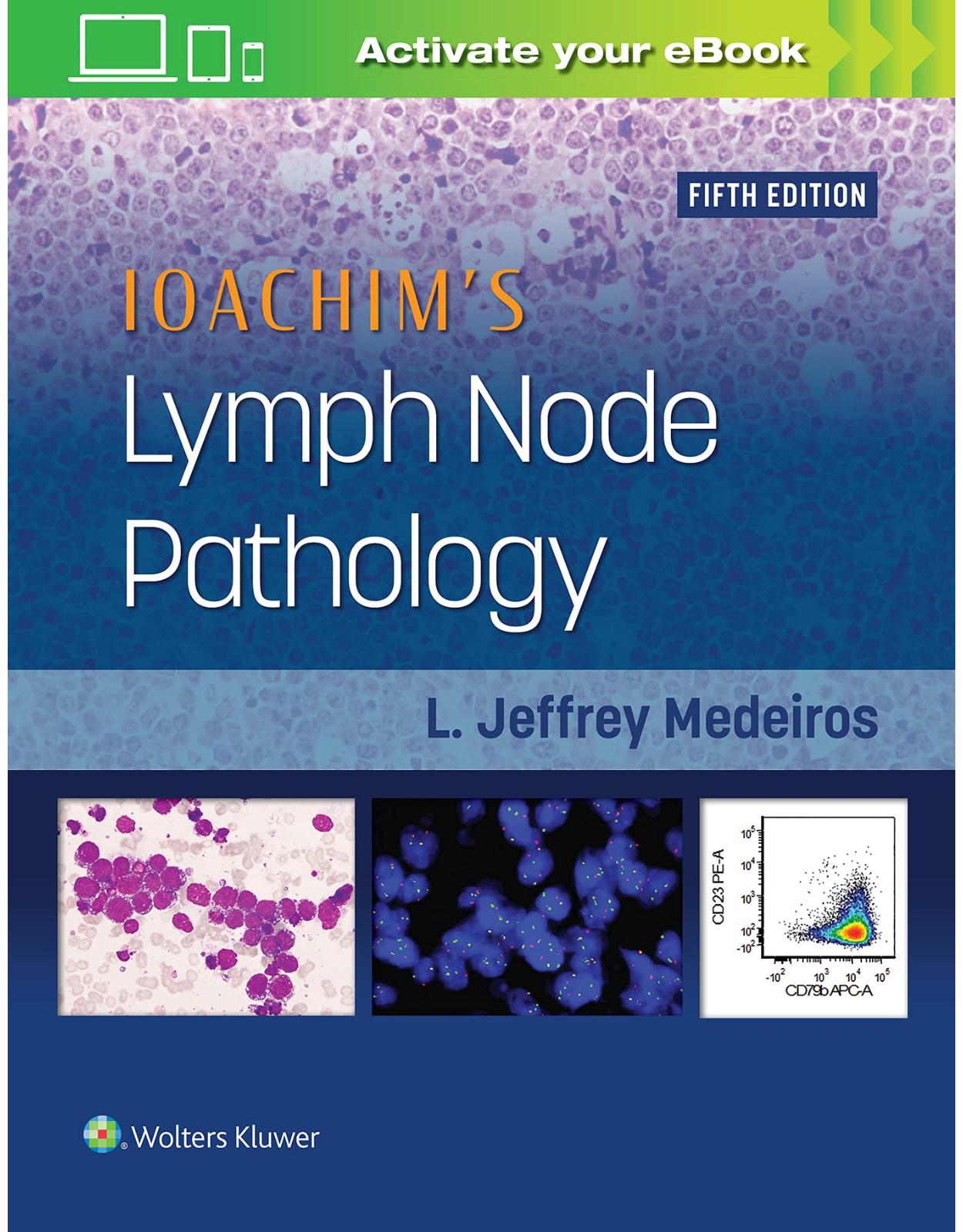 Ioachim’s Lymph Node Pathology