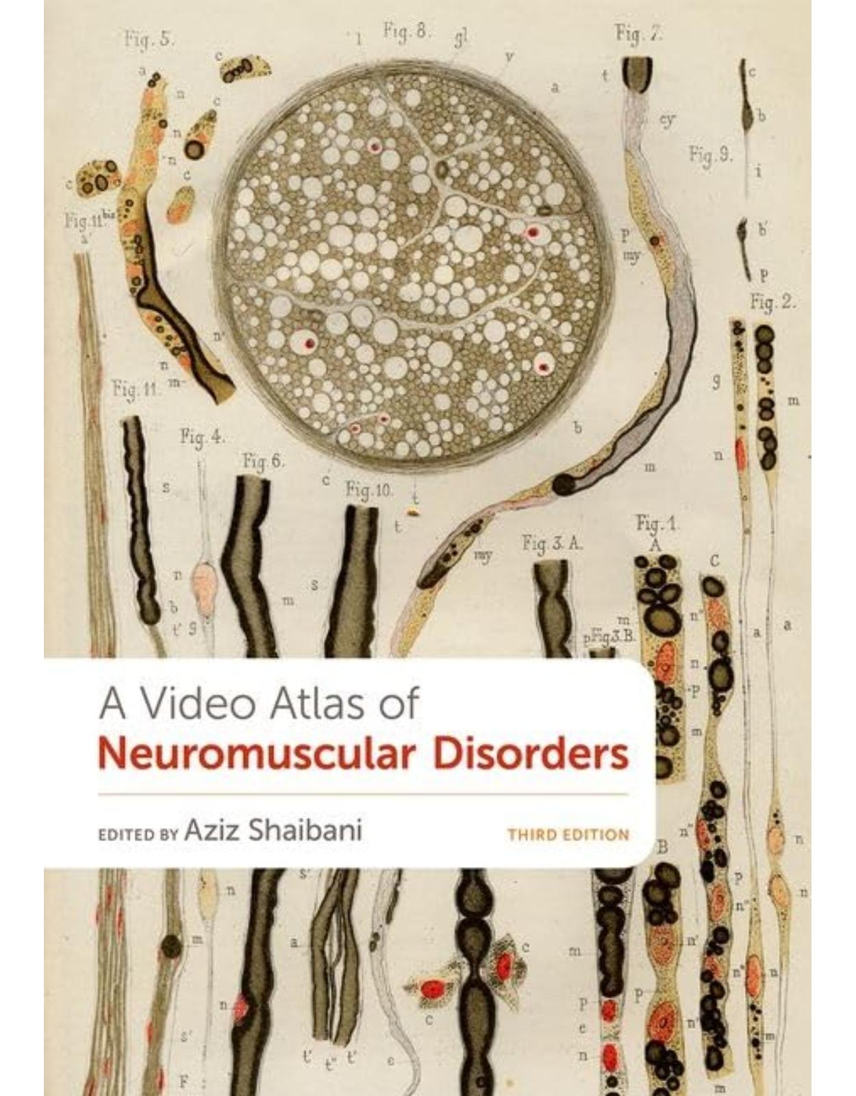 A Video Atlas of Neuromuscular Disorders