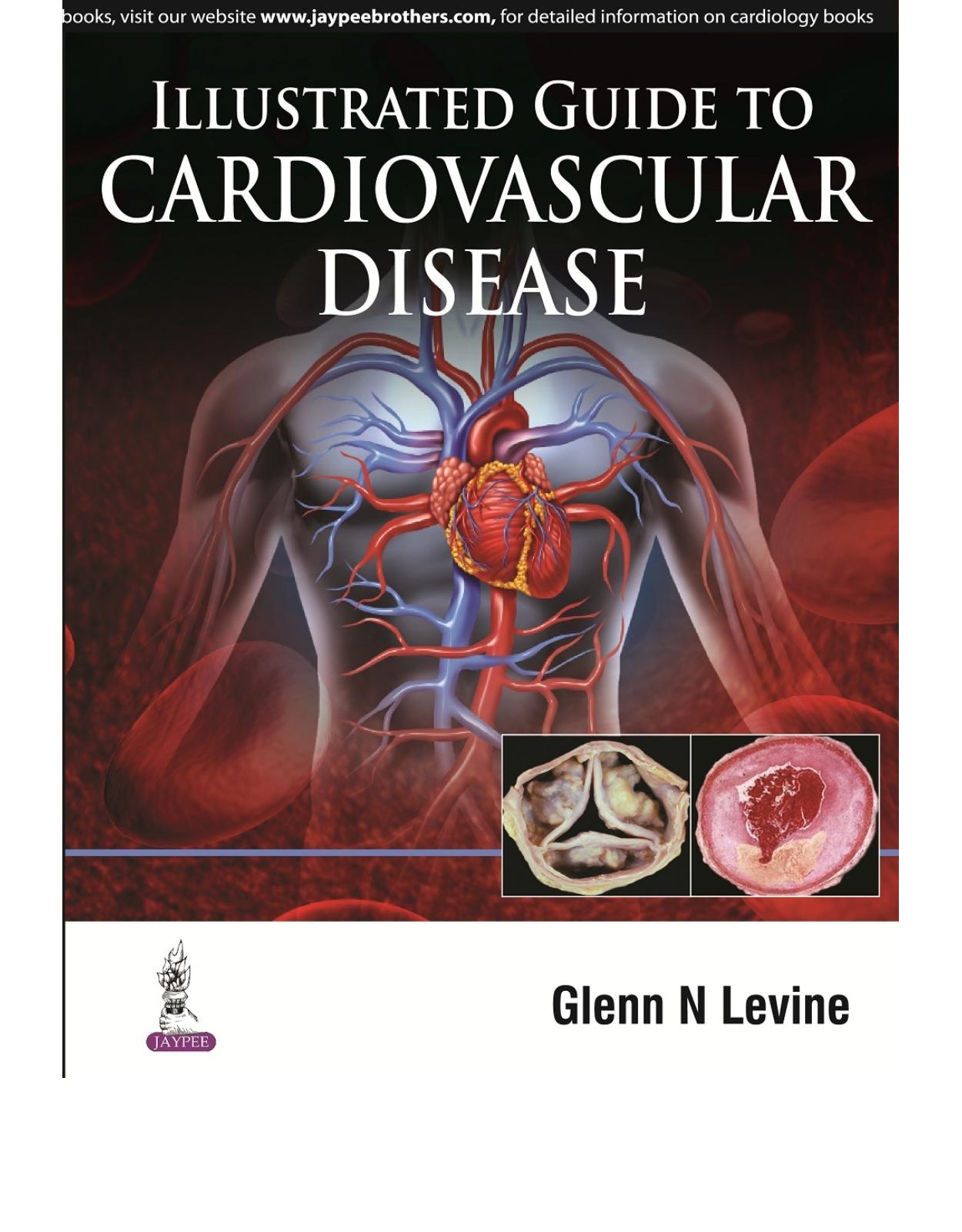  Illustrated Guide to Cardiovascular Disease