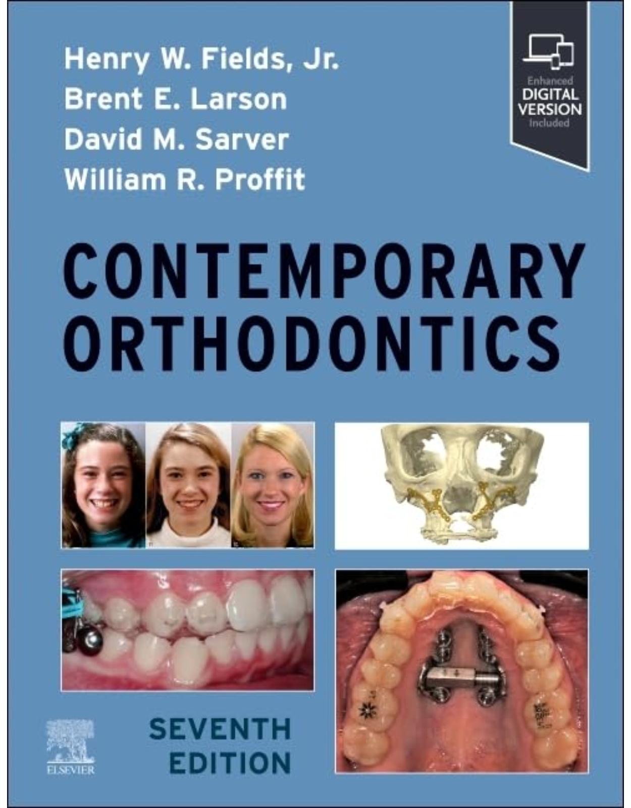 Contemporary Orthodontics