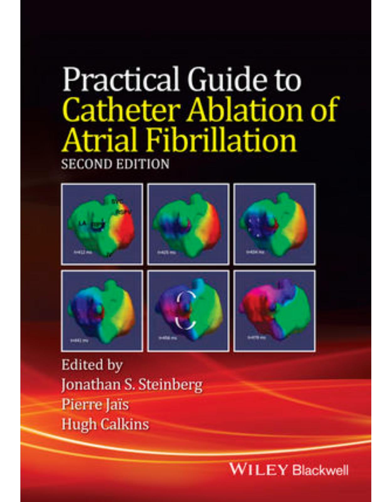 Practical Guide to Catheter Ablation of Atrial Fibrillation