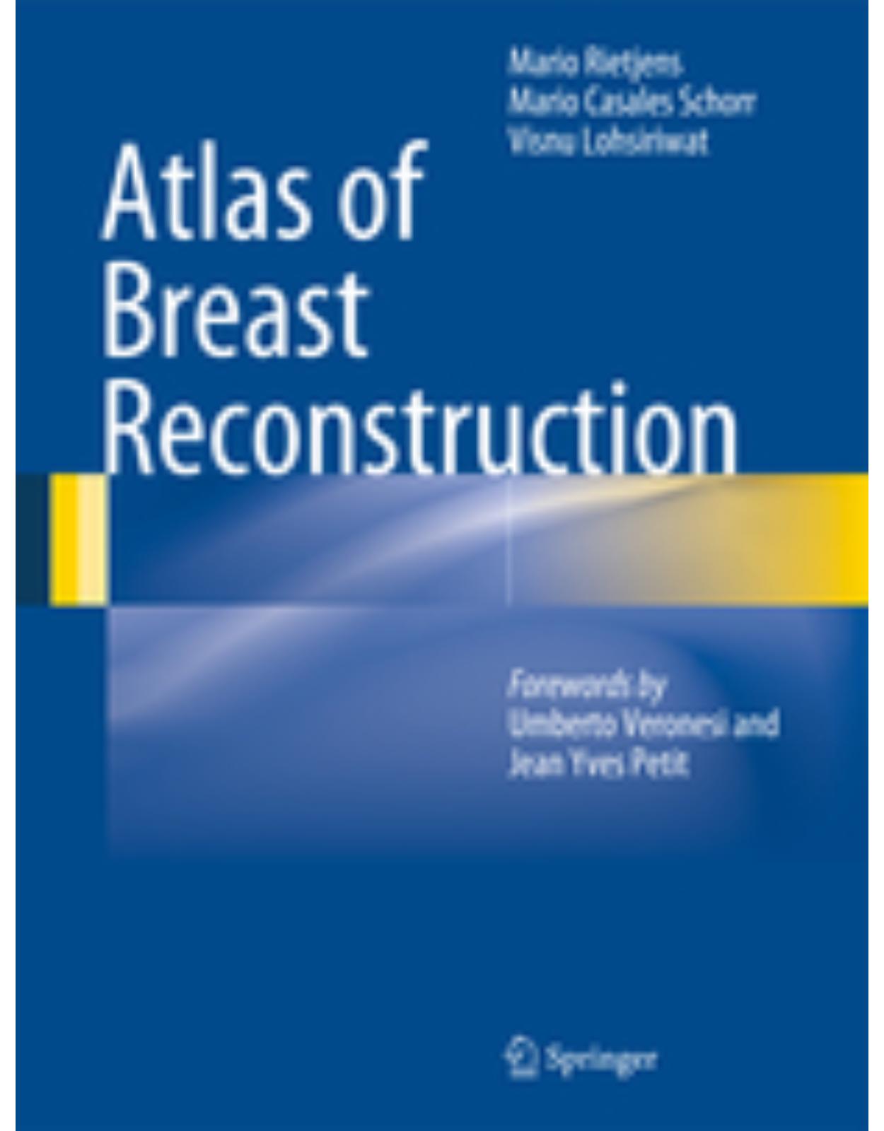 Atlas of Breast Reconstruction