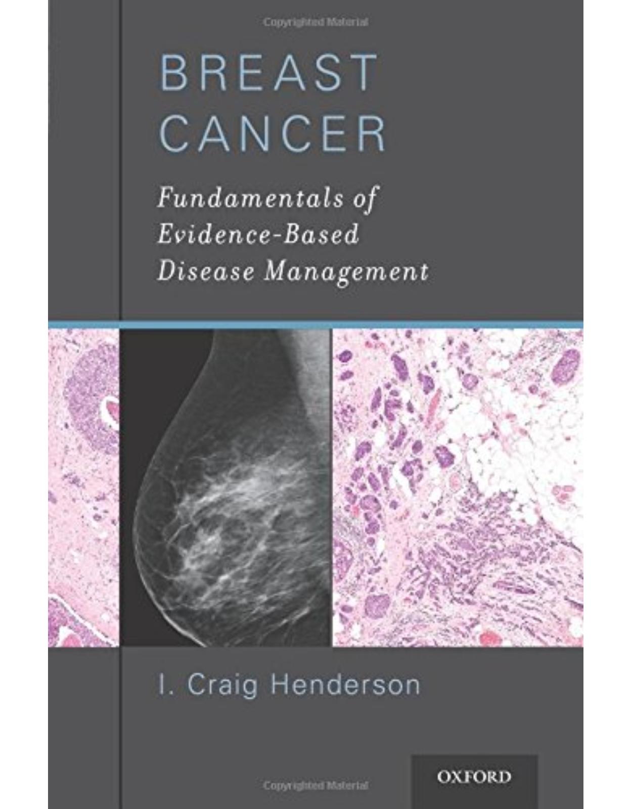 Breast Cancer. Fundamentals of Evidence-Based Disease Management