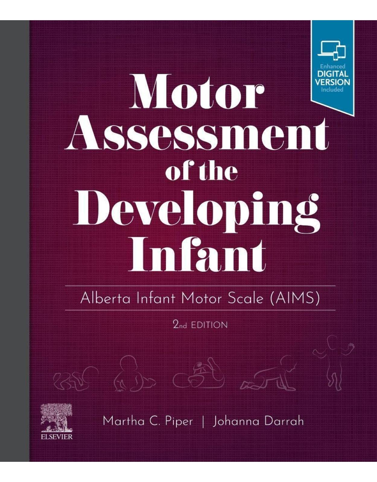 Motor Assessment of the Developing Infant: Alberta Infant Motor Scale (AIMS)