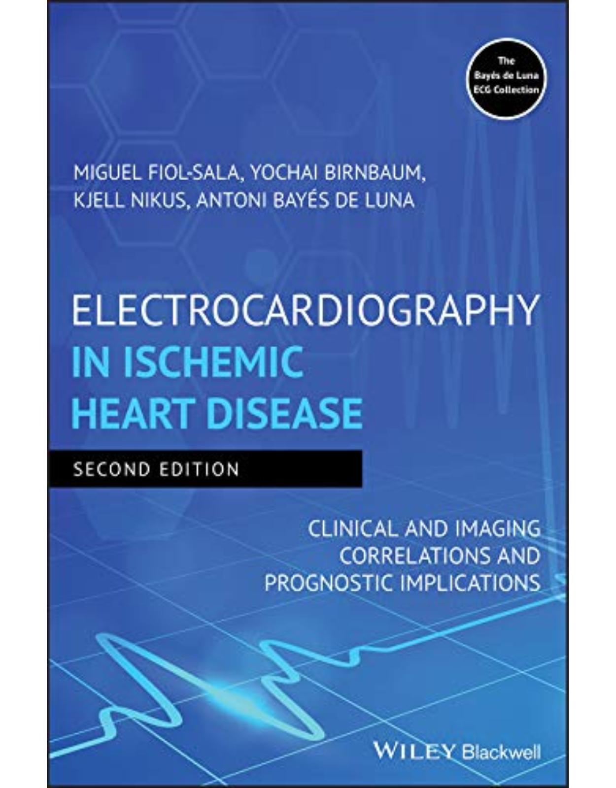 Electrocardiography in Ischemic Heart Disease: Clinical and Imaging Correlations and Prognostic Implications