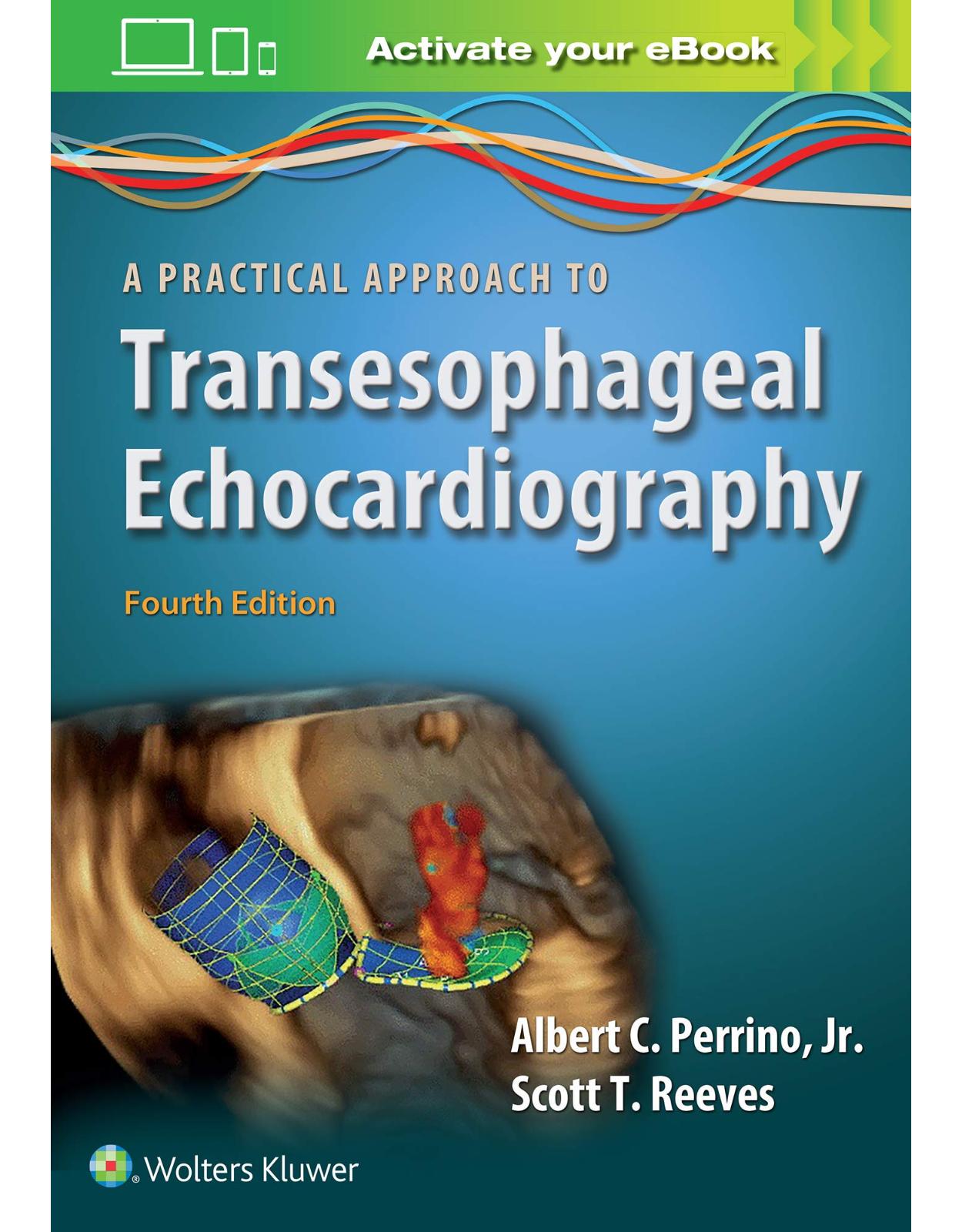 A Practical Approach to Transesophageal Echocardiography