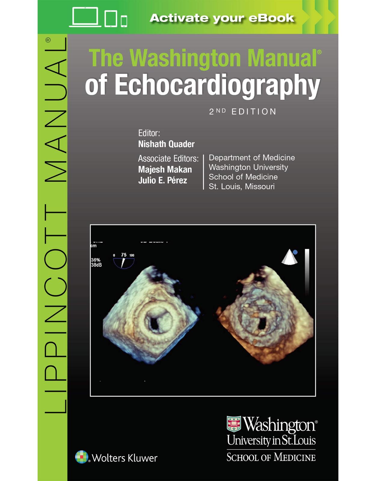 The Washington Manual of Echocardiography