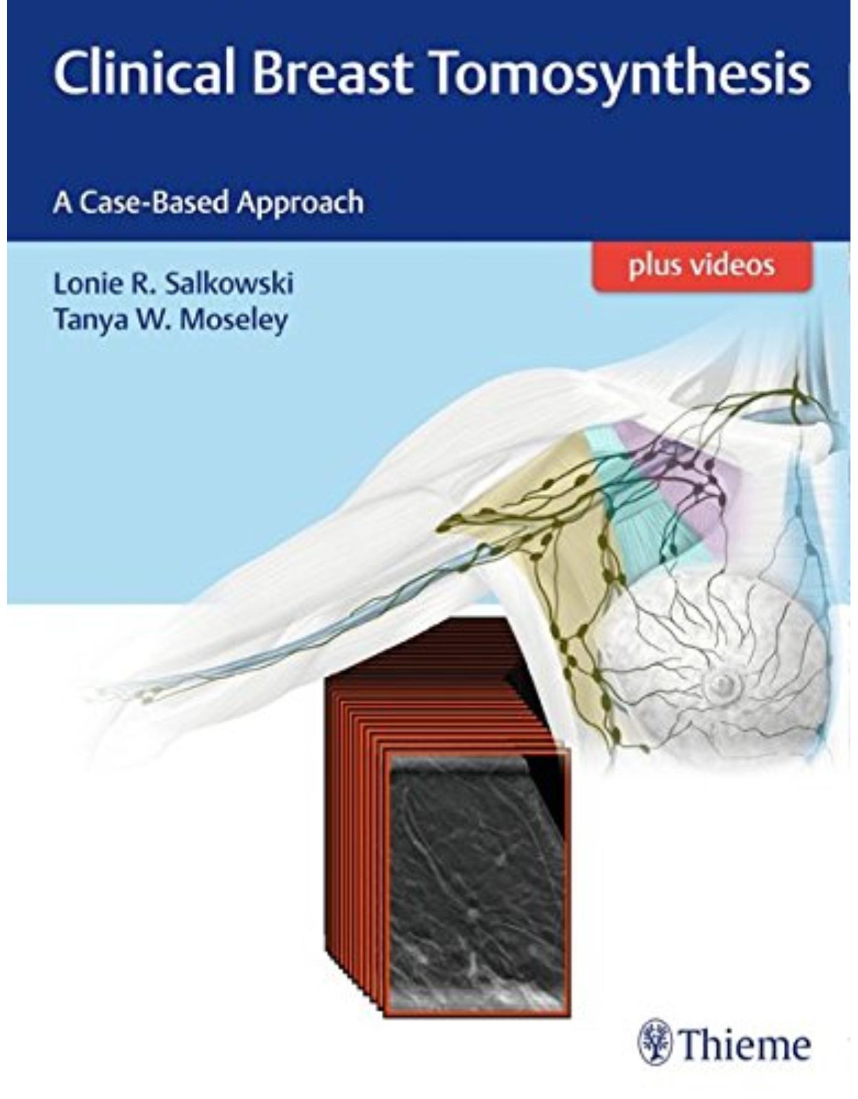 Clinical Breast Tomosynthesis