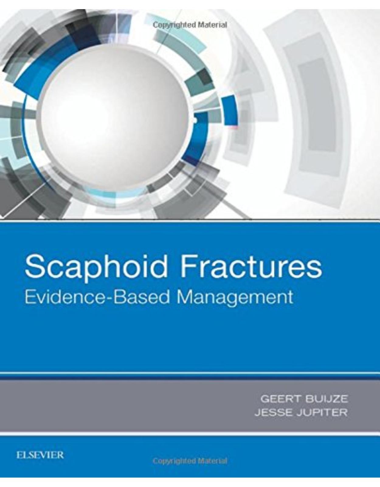 Scaphoid Fractures: Evidence-Based Management, 1e 