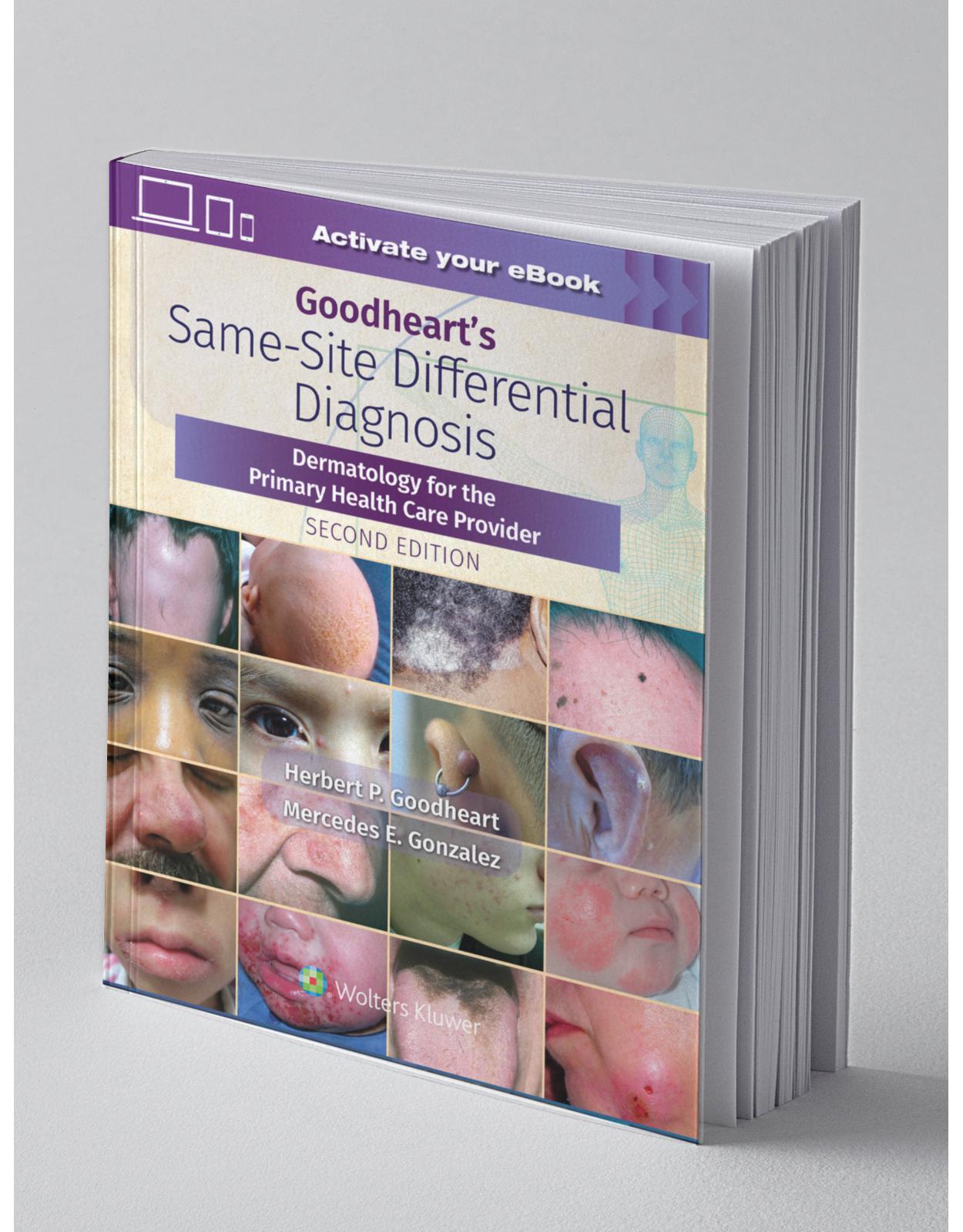 Goodhearts Same-Site Differential Diagnosis Dermatology for the Primary Health Care Provider, Second edition