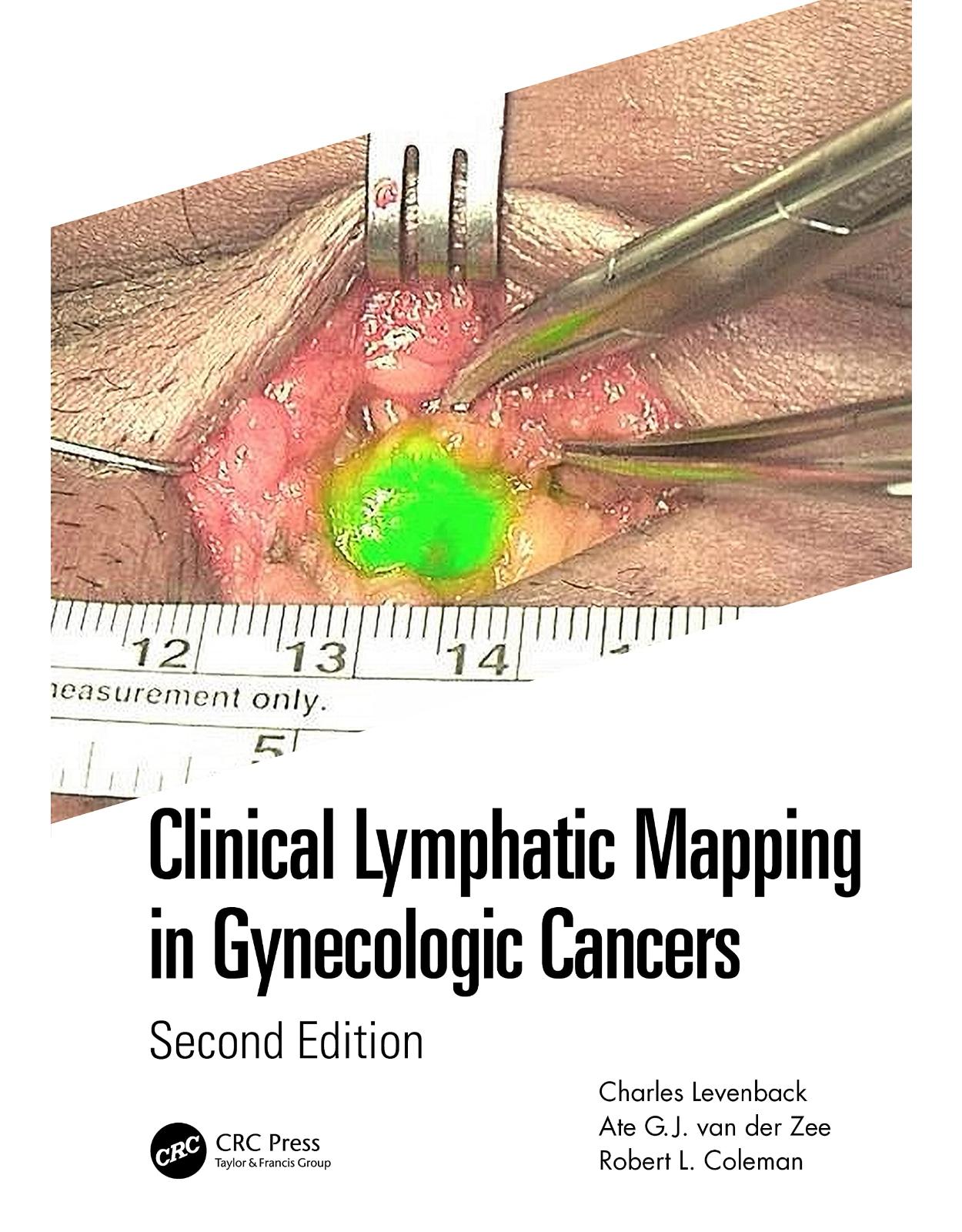 Clinical Lymphatic Mapping in Gynecologic Cancers 