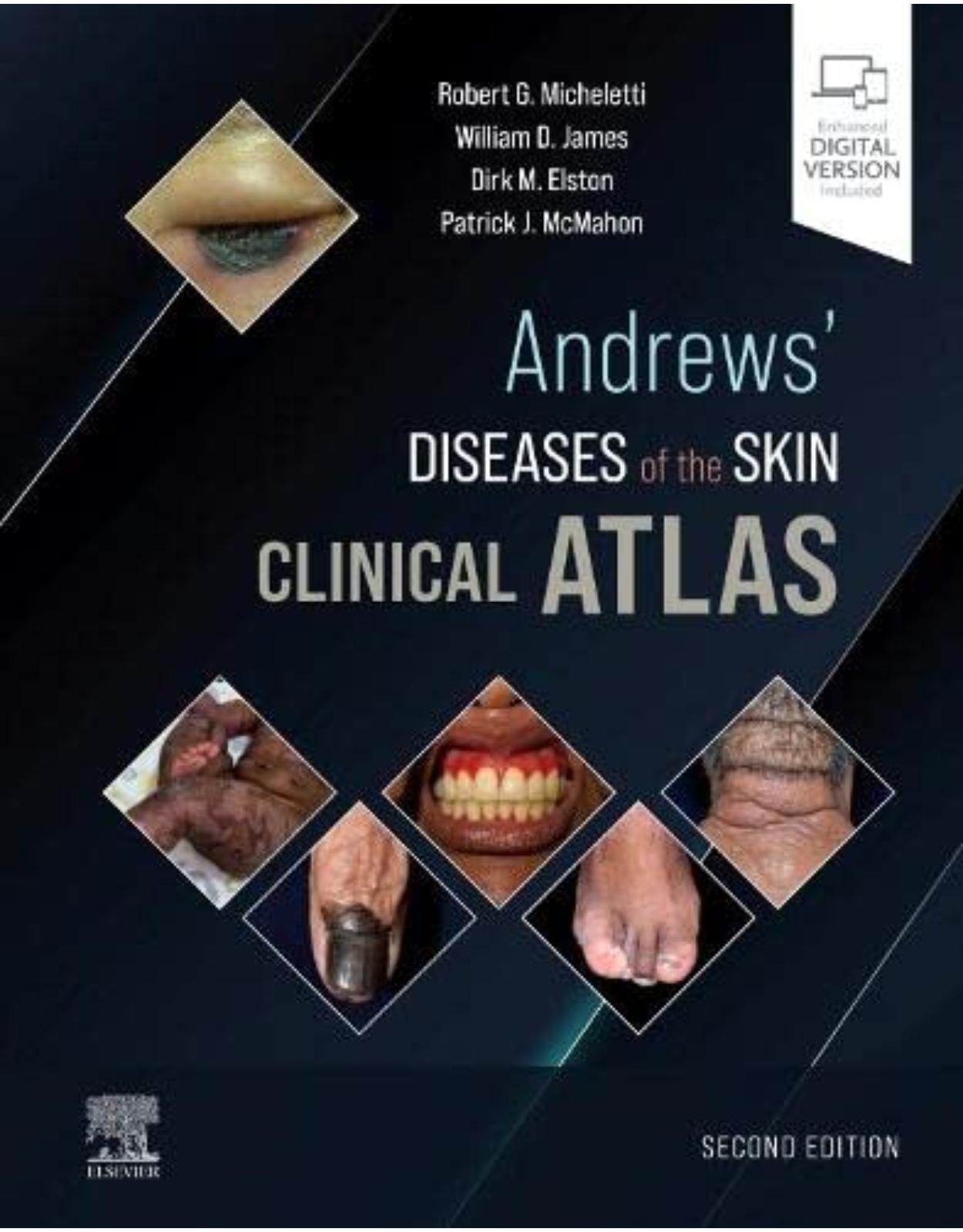 Andrews’ Diseases of the Skin Clinical Atlas