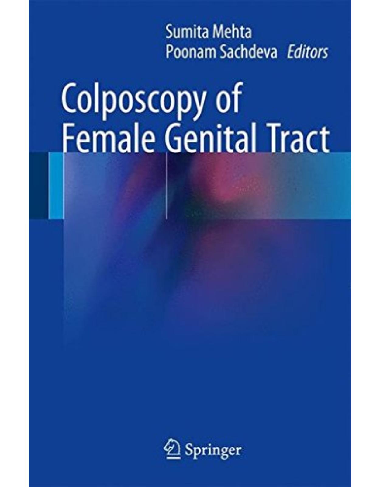 Colposcopy of Female Genital Tract