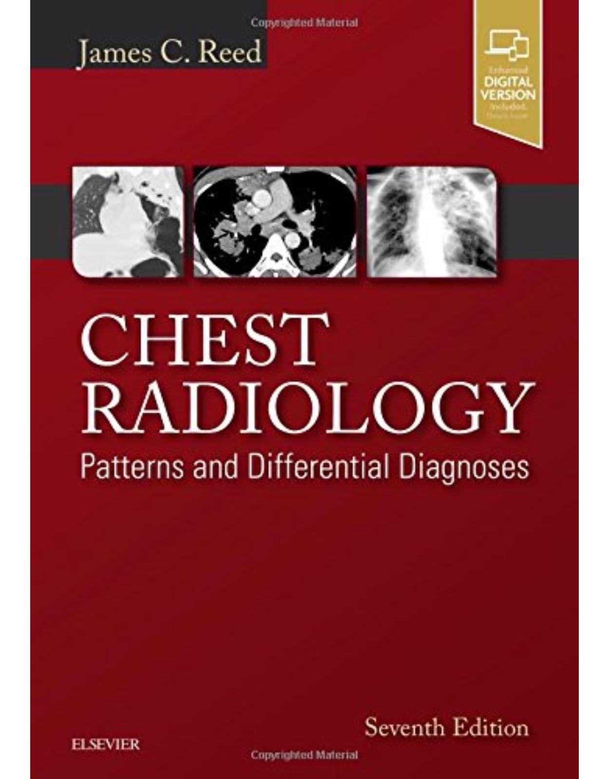 Chest Radiology: Patterns and Differential Diagnoses