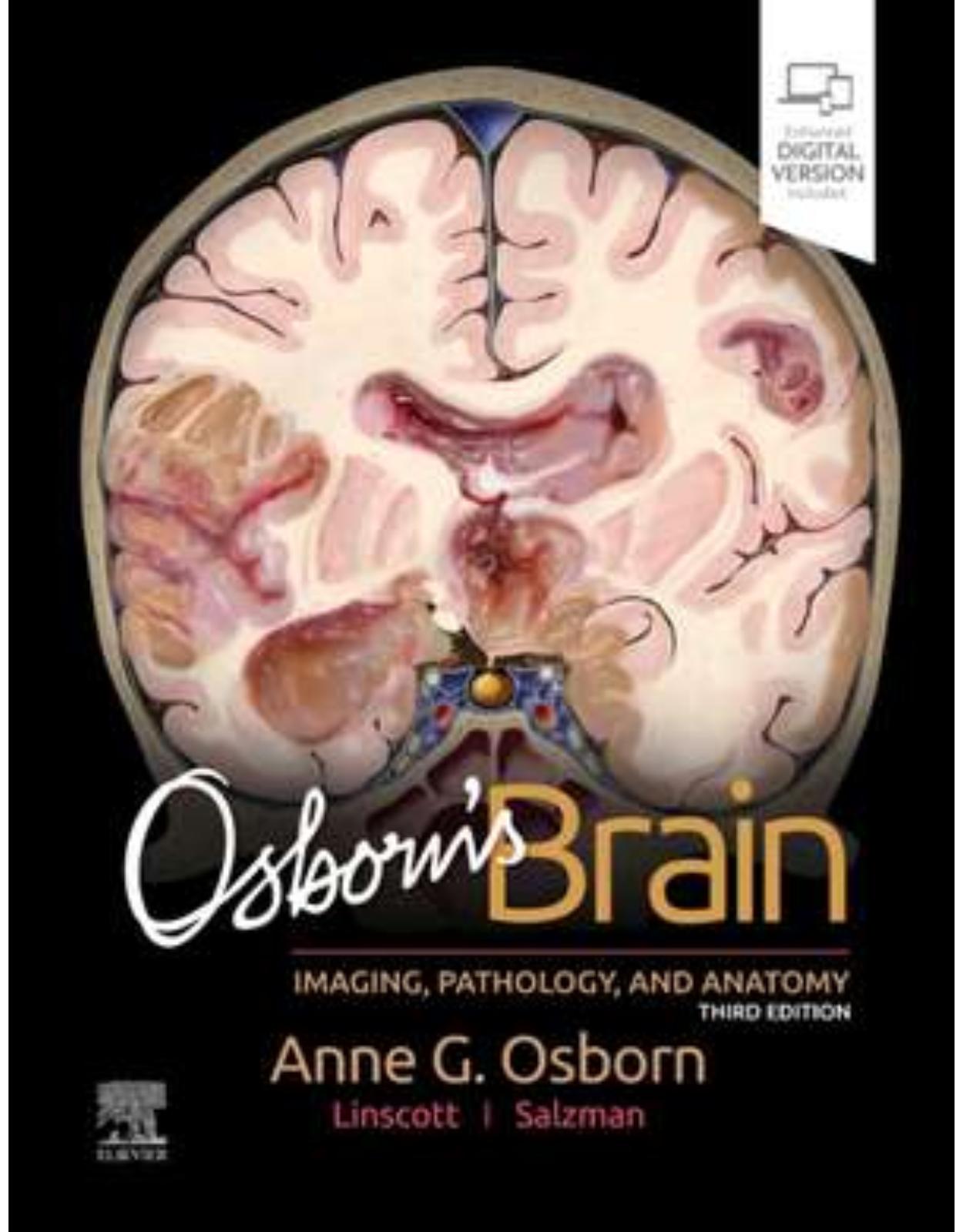 Osborns Brain, 3rd Edition