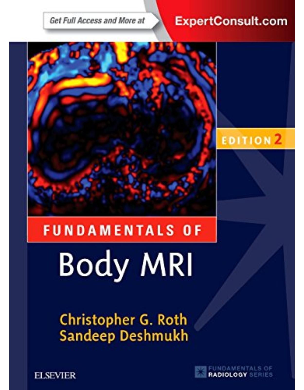 Fundamentals of Body MRI, 2e (Fundamentals of Radiology)