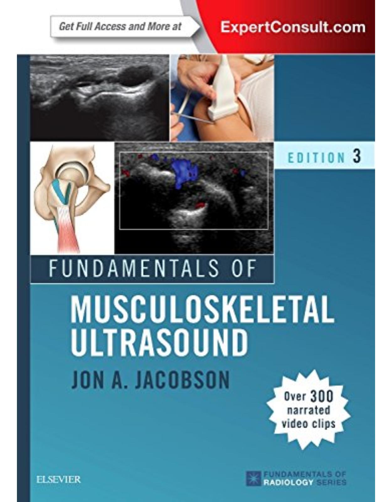 Fundamentals of Musculoskeletal Ultrasound, 3e (Fundamentals of Radiology) 