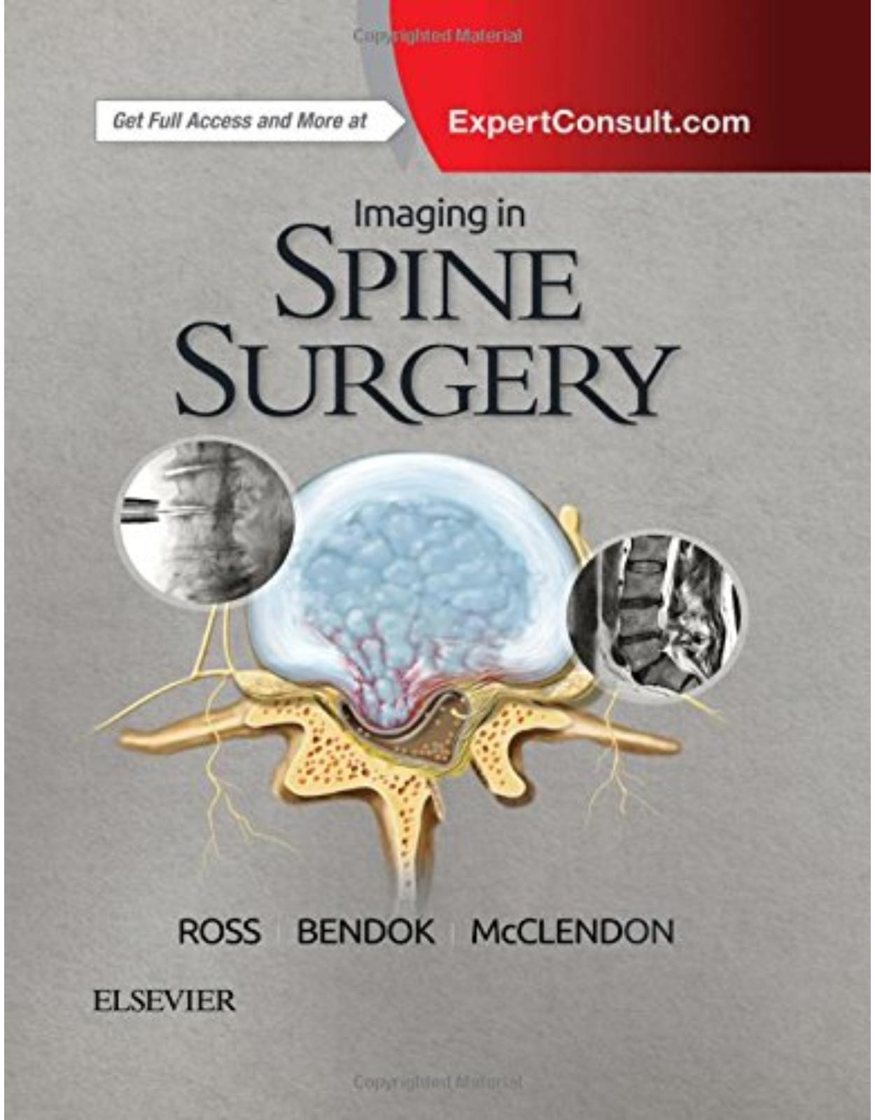 Imaging in Spine Surgery, 1e