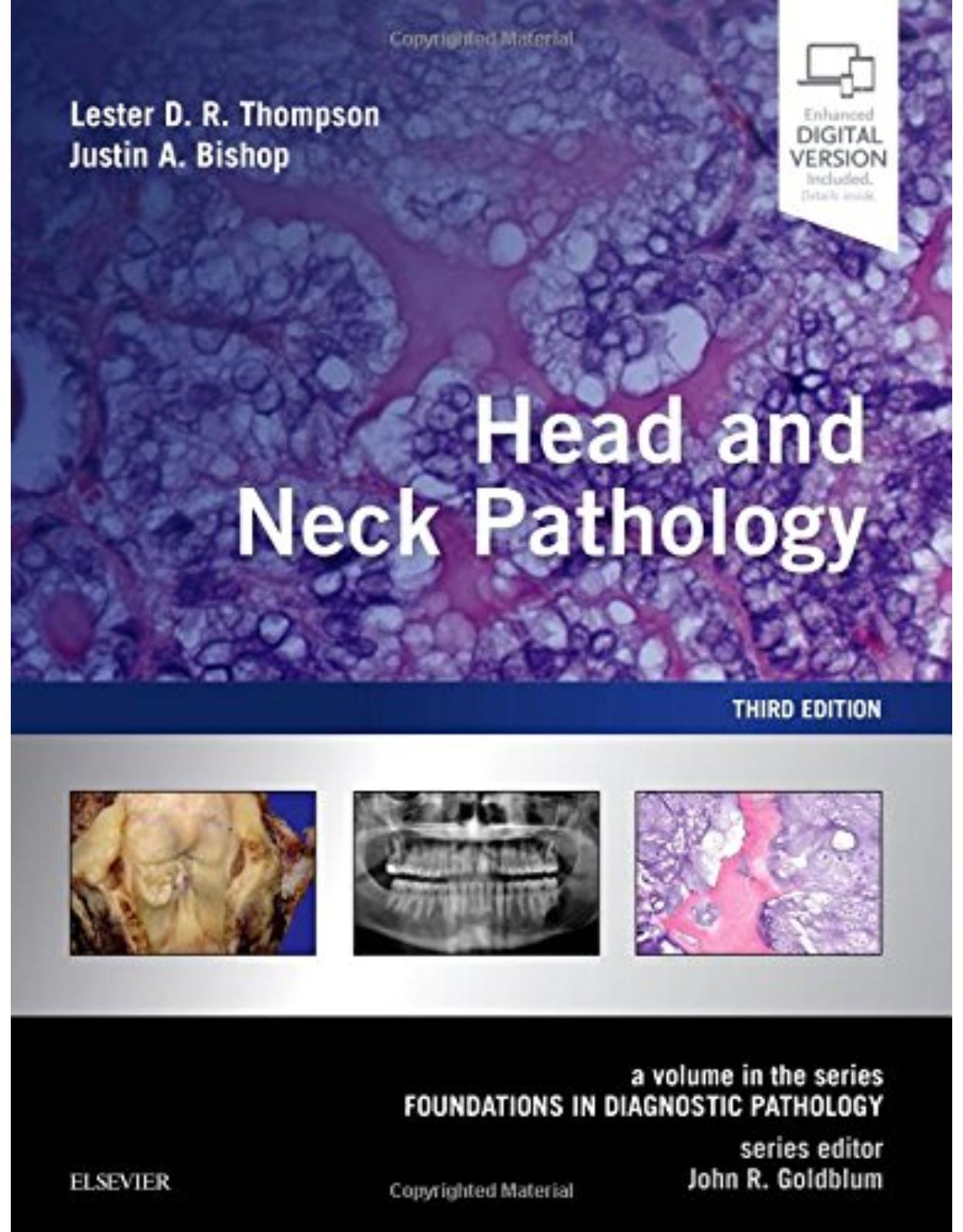 Head and Neck Pathology: A Volume in the Series: Foundations in Diagnostic Pathology, 3e