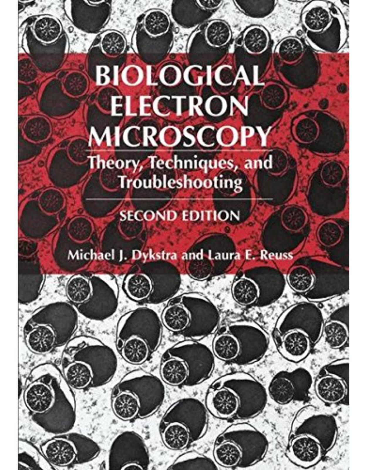 Biological Electron Microscopy: 