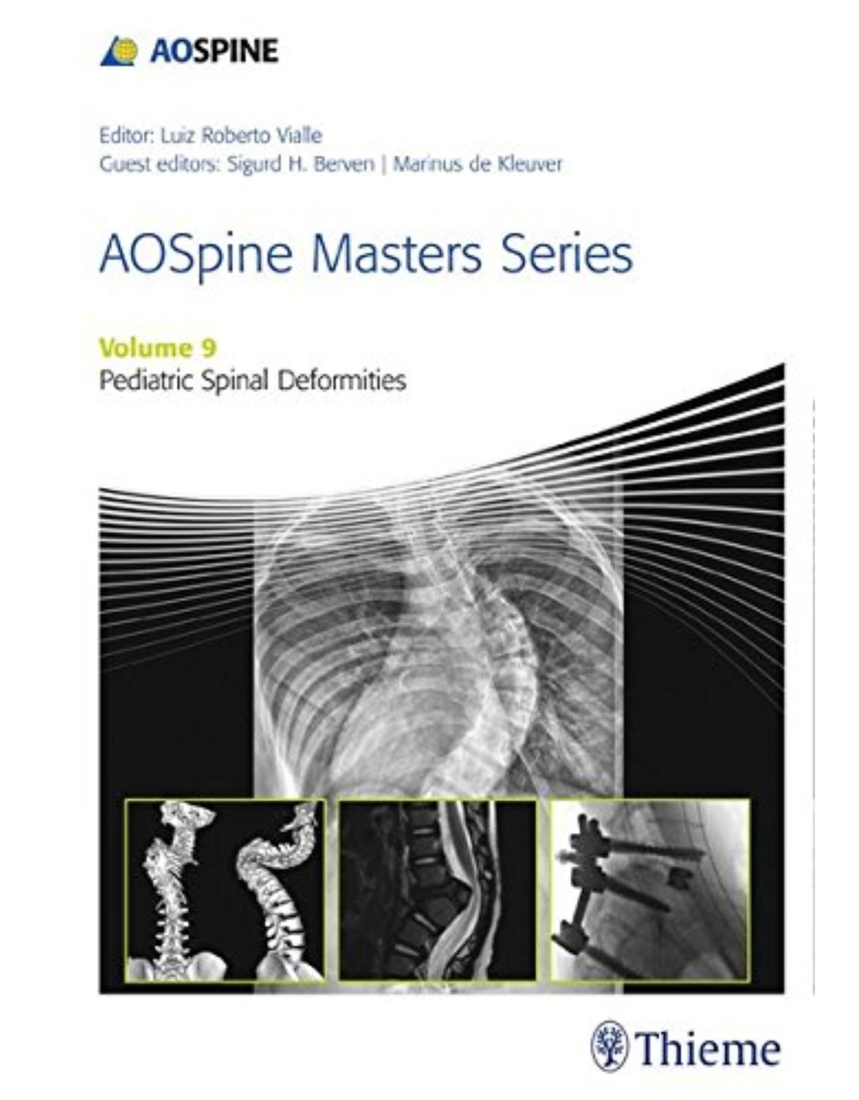 AOSpine Masters Series, Volume 9: Pediatric Spinal Deformities