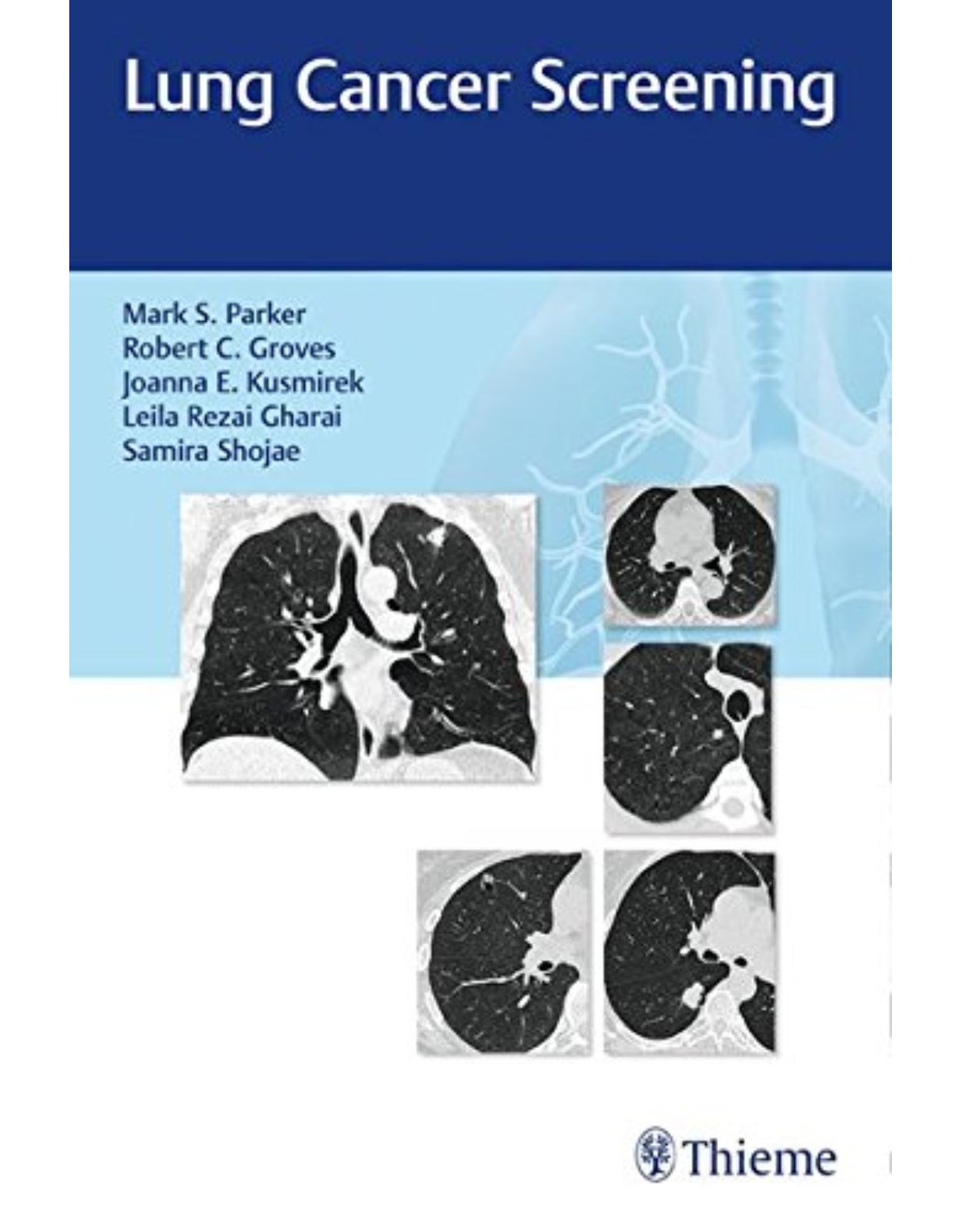 Lung Cancer Screening