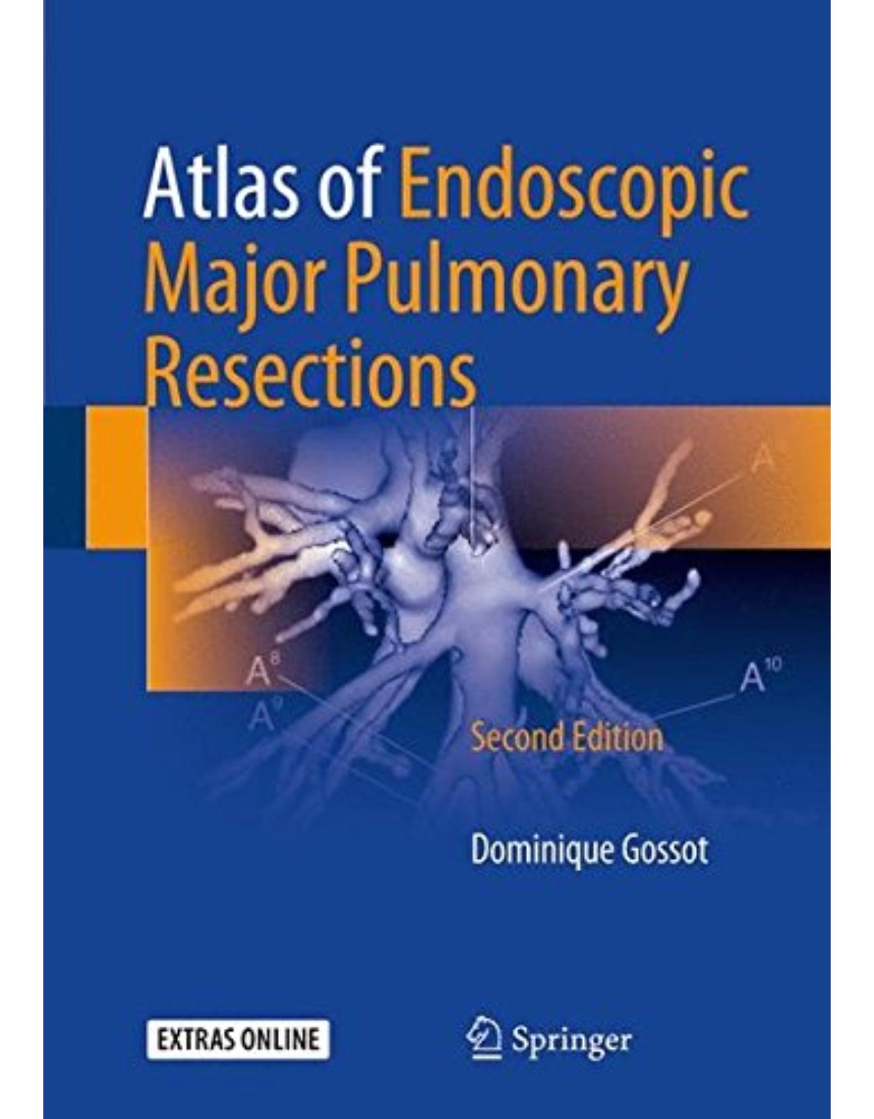 Atlas of Endoscopic Major Pulmonary Resections