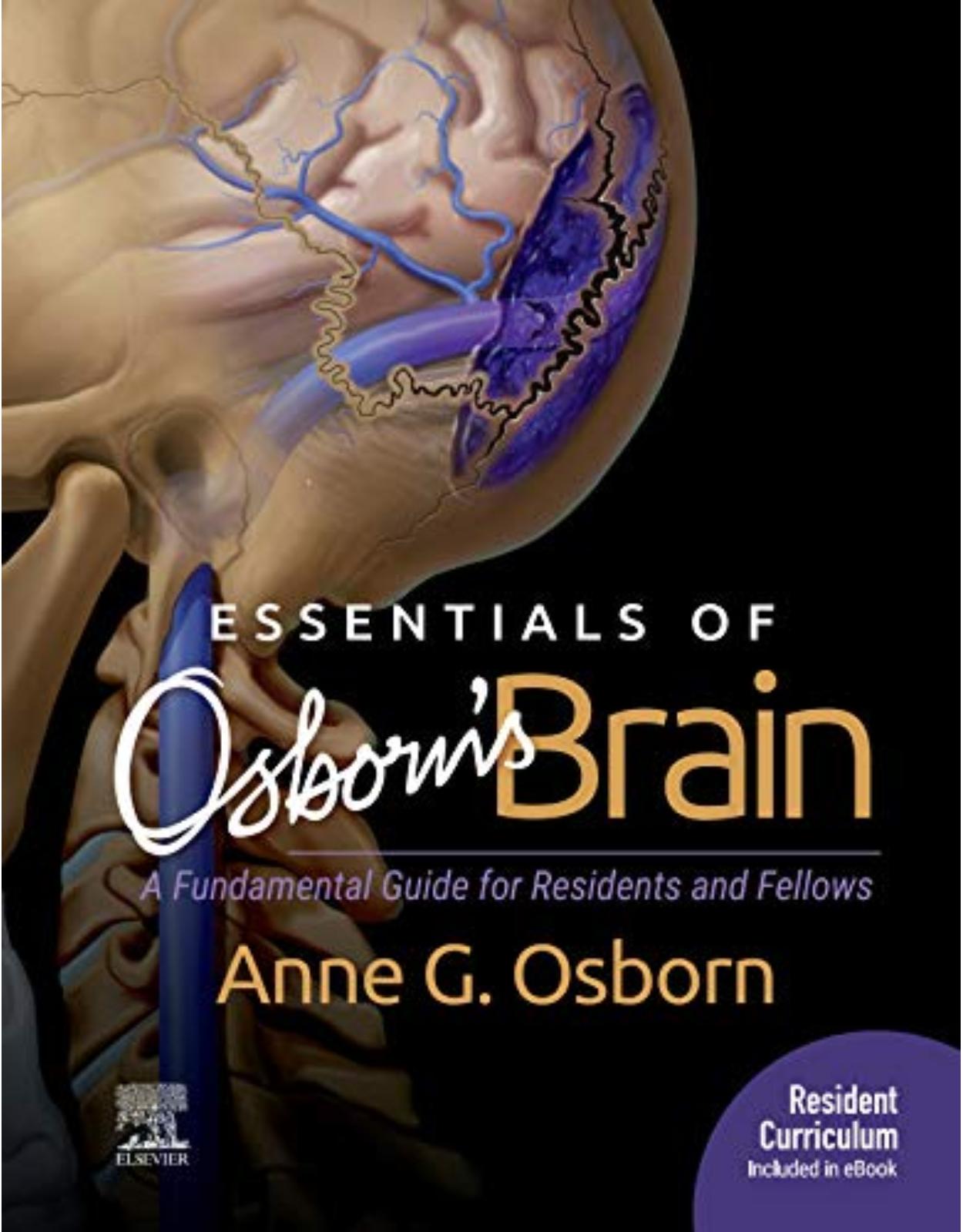 Essentials of Osborn’s Brain