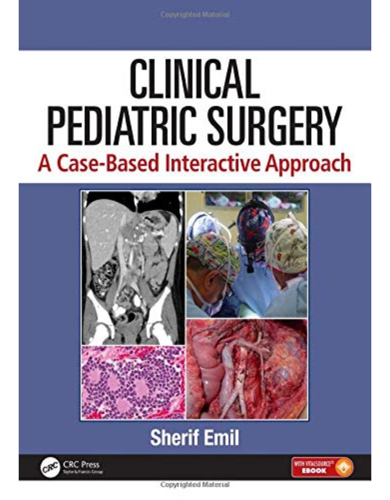 Clinical Pediatric Surgery: A Case-Based Interactive Approach