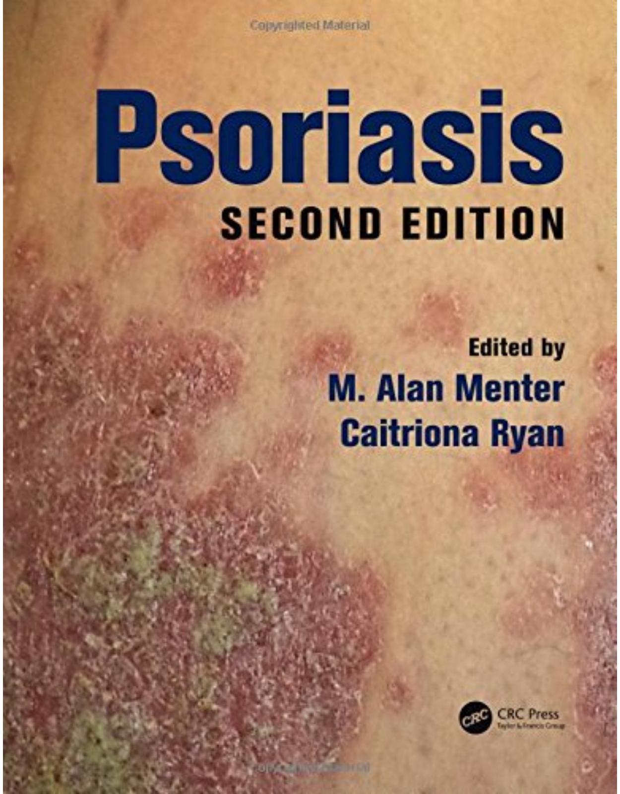 Psoriasis, Second Edition 